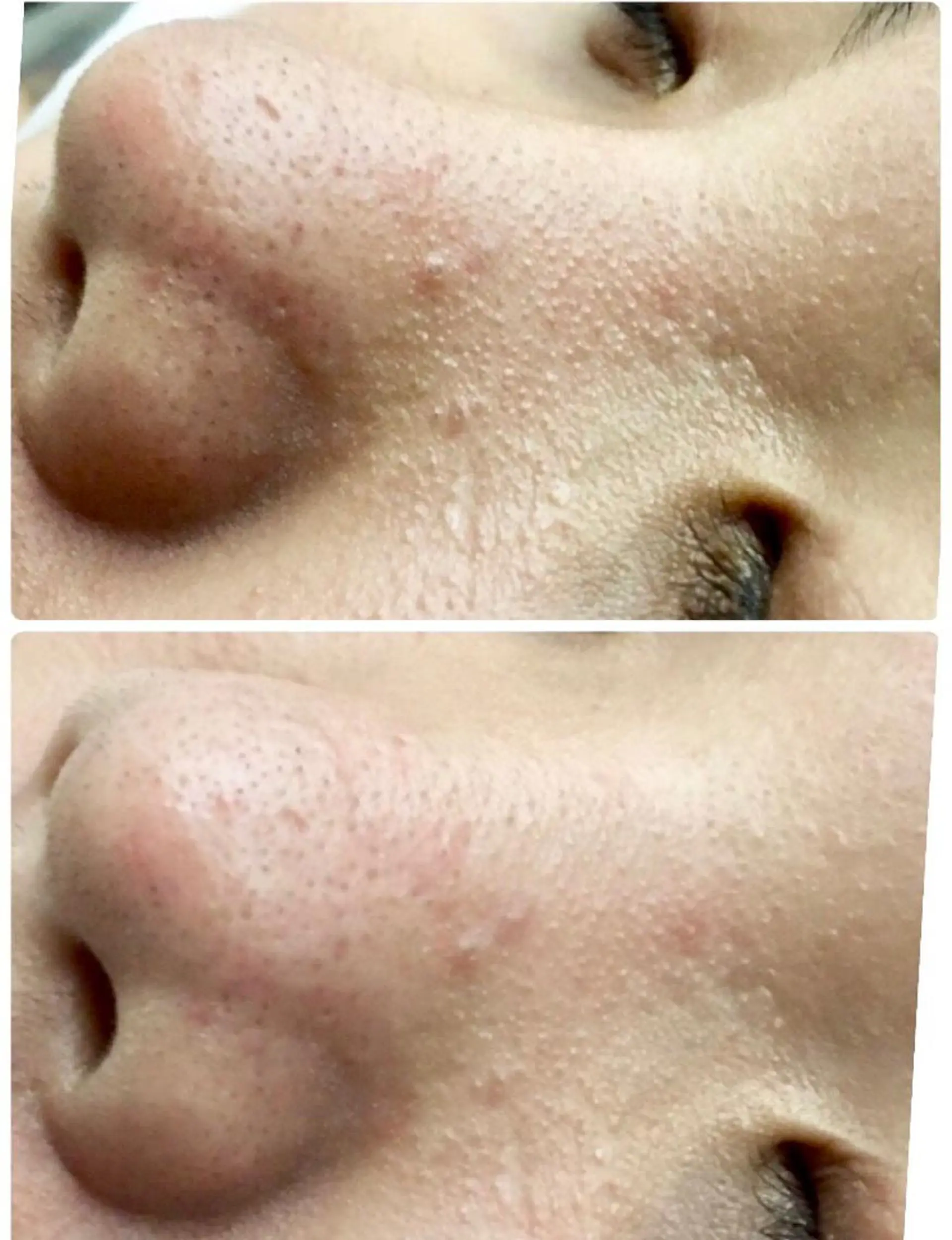 ハーブピーリングMB eautySalonのエステ・リラクイメージ