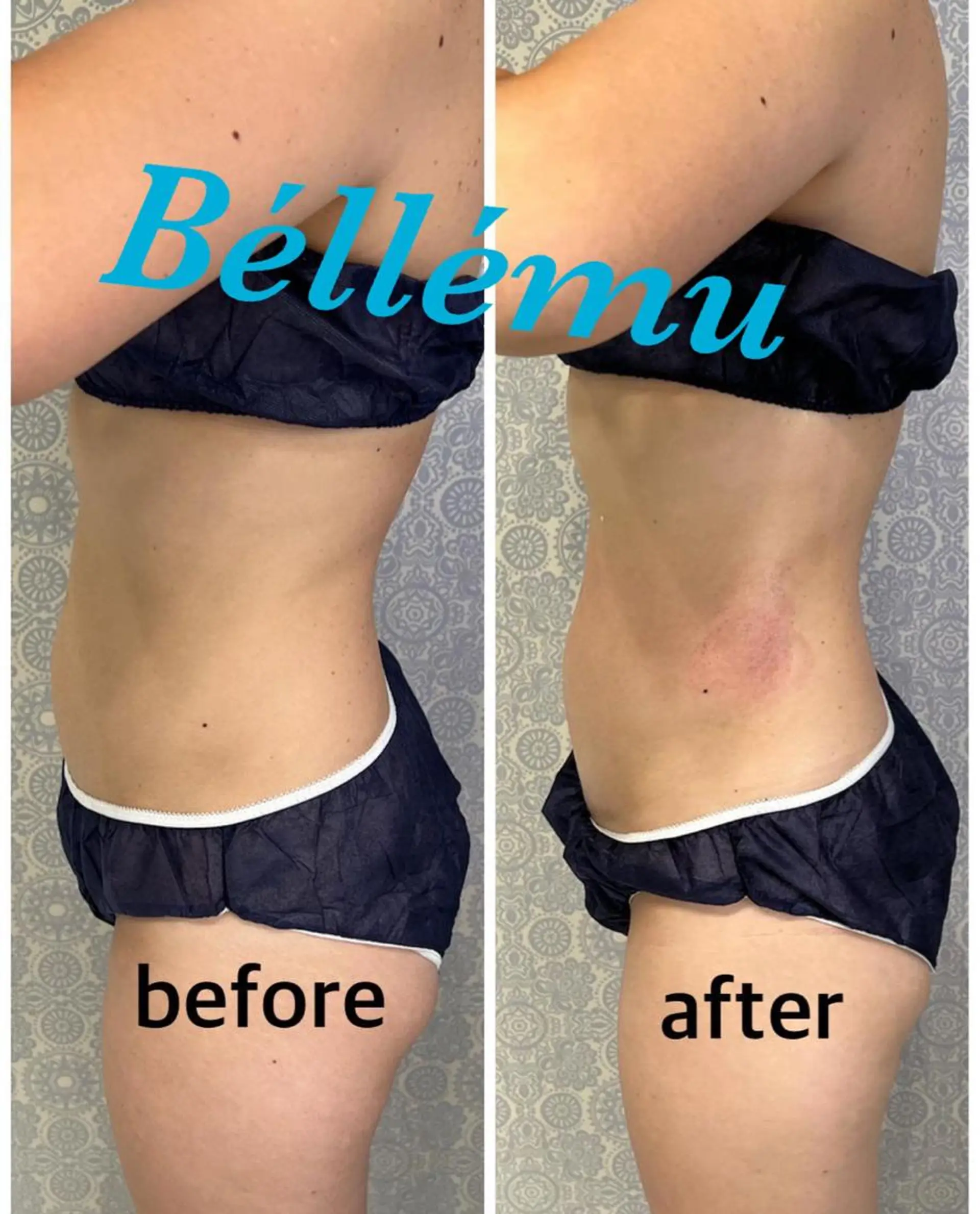 エステ Salon de Béllému所属・Béllému ﾍﾞﾙｴﾐｭ　あおいのエステ・リラクイメージ