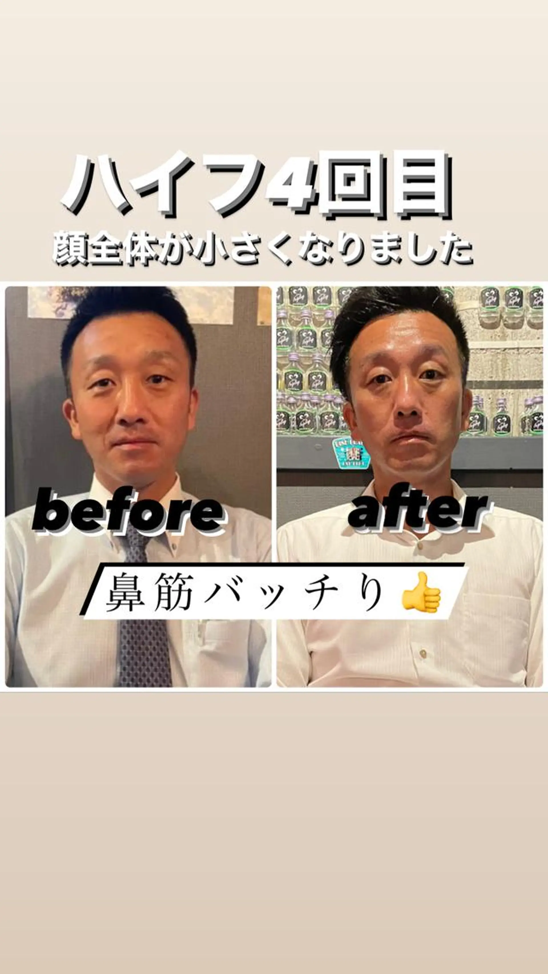 メンズ CRAZY NAILのネイルデザイン