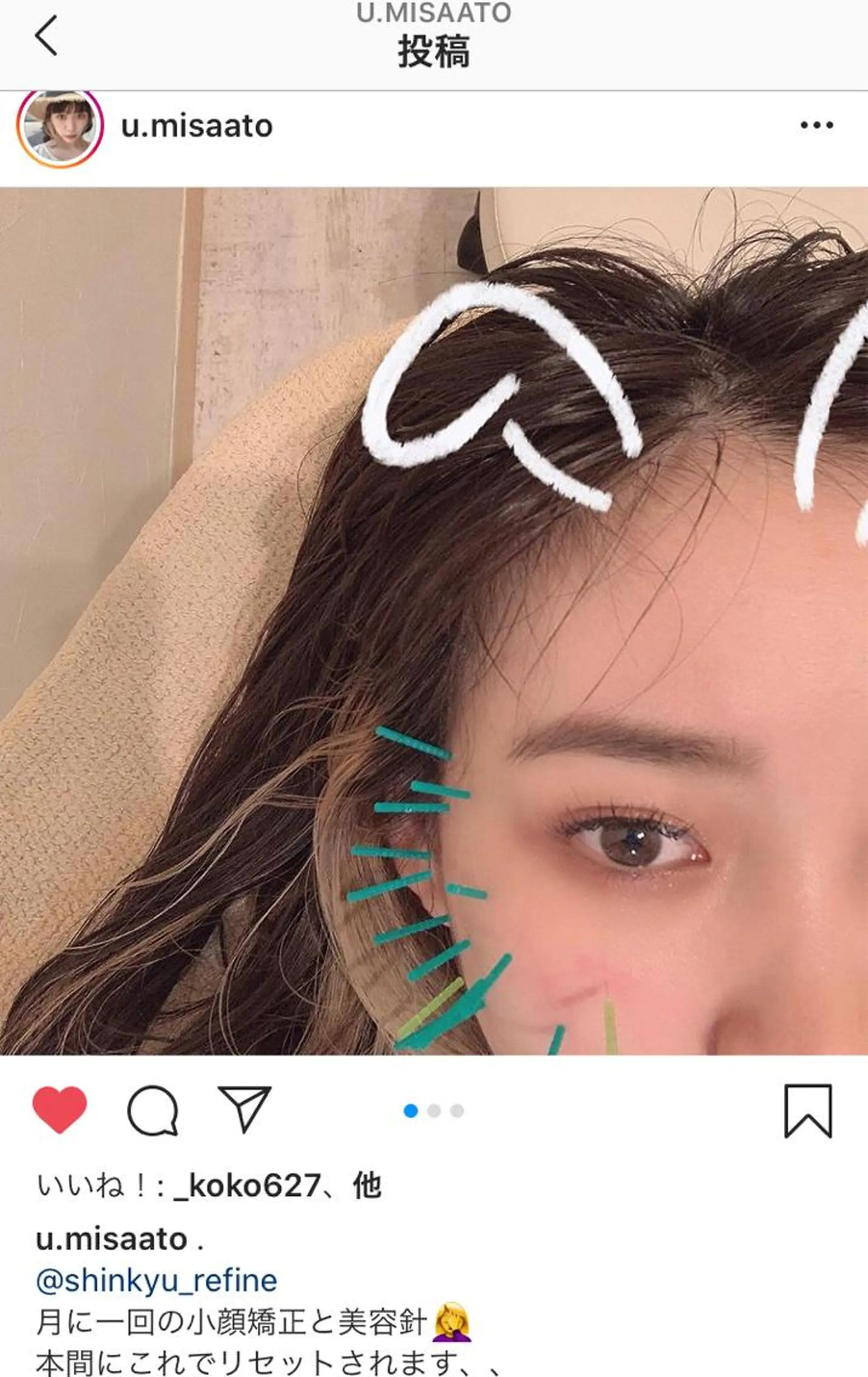 鍼灸整骨院Refine所属・鍼灸 Refineのその他イメージ