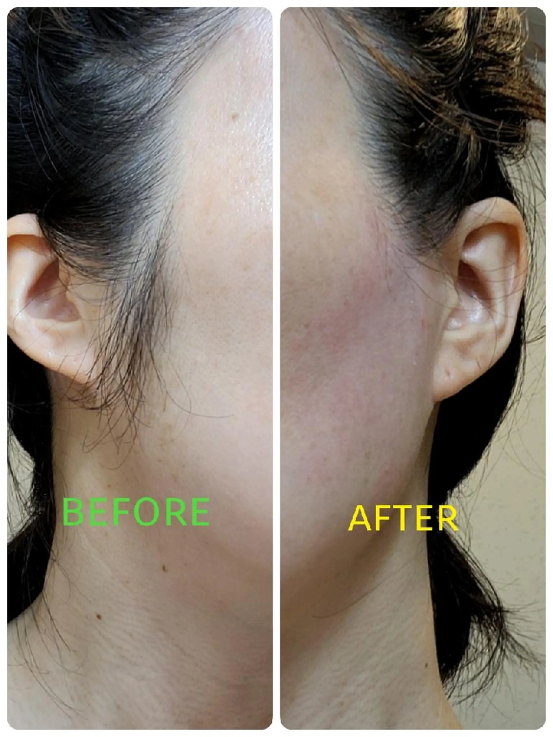 脱毛 輿 桂のヘアスタイル