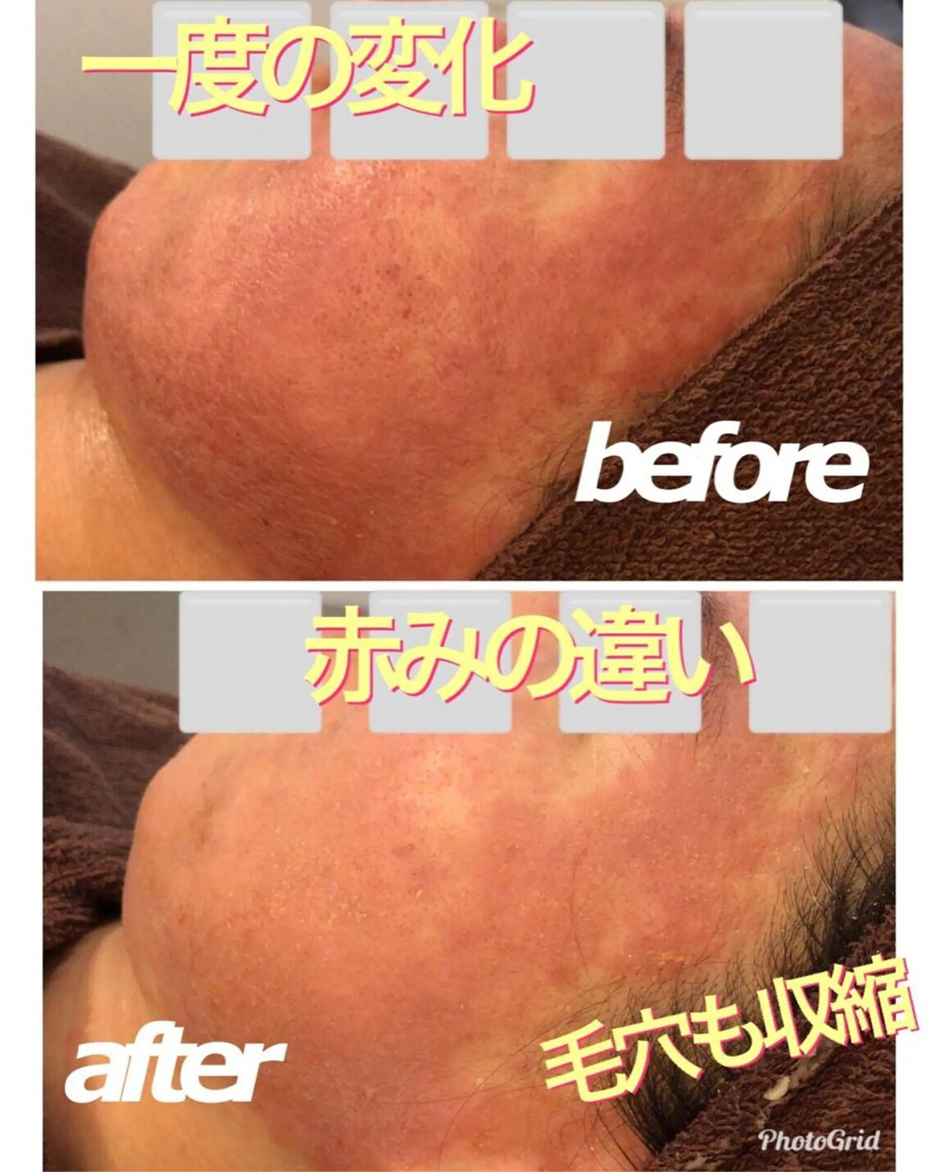 ロング カラー パーマ ヘアアレンジ メンズ キッズ ネイル マツエク・マツパ 四つ星サロン🎖 腸＆ニキビケアに特化のエステ・リラクイメージ