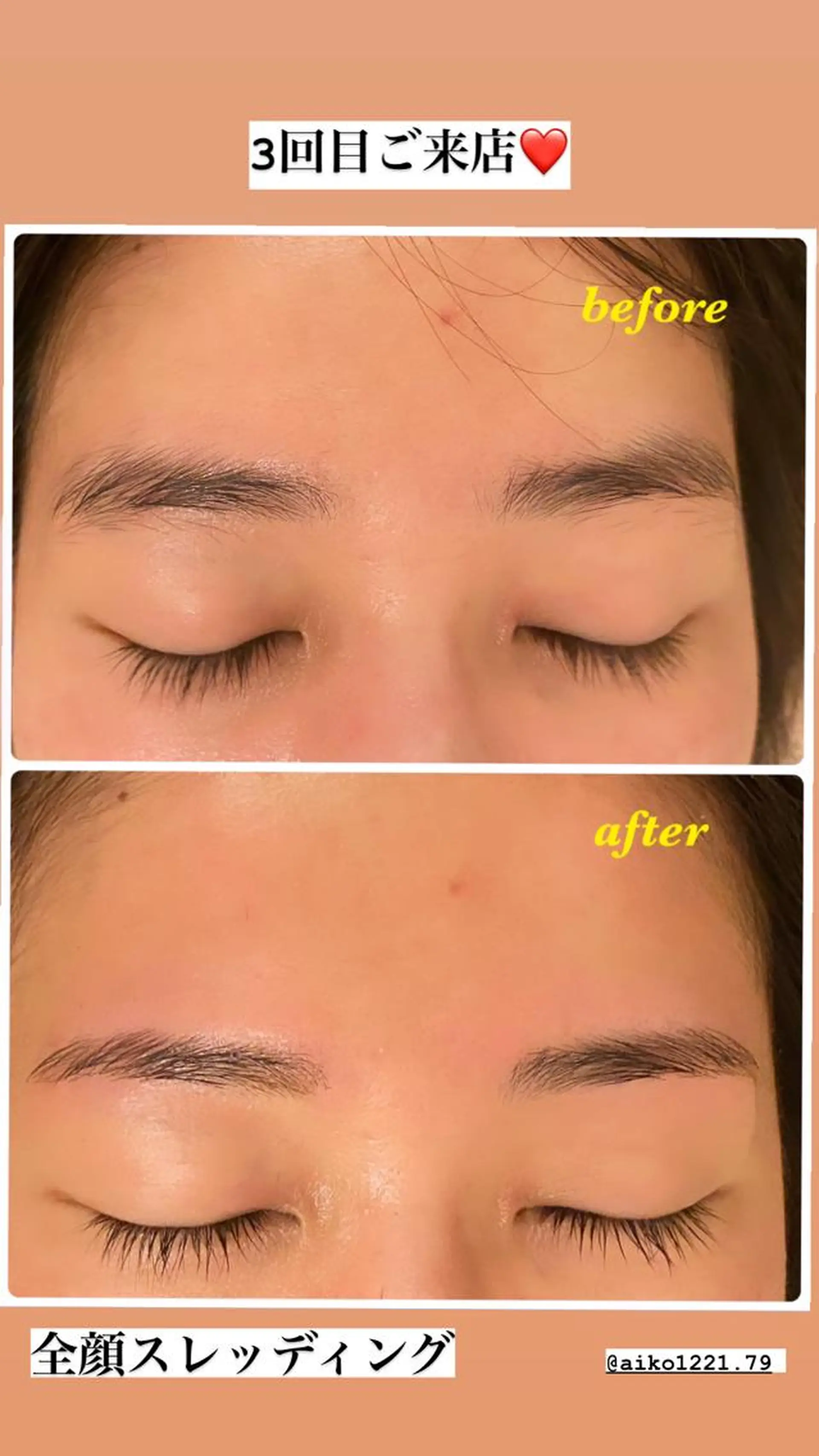 アイブロウ ハーブピーリング/韓国肌管理/フェイシャル/毛穴洗浄/眉毛/顔脱毛【糸脱毛専門】rev所属・ハーブピーリング🌹 毛穴洗浄❤️眉waxのエステ・リラクイメージ