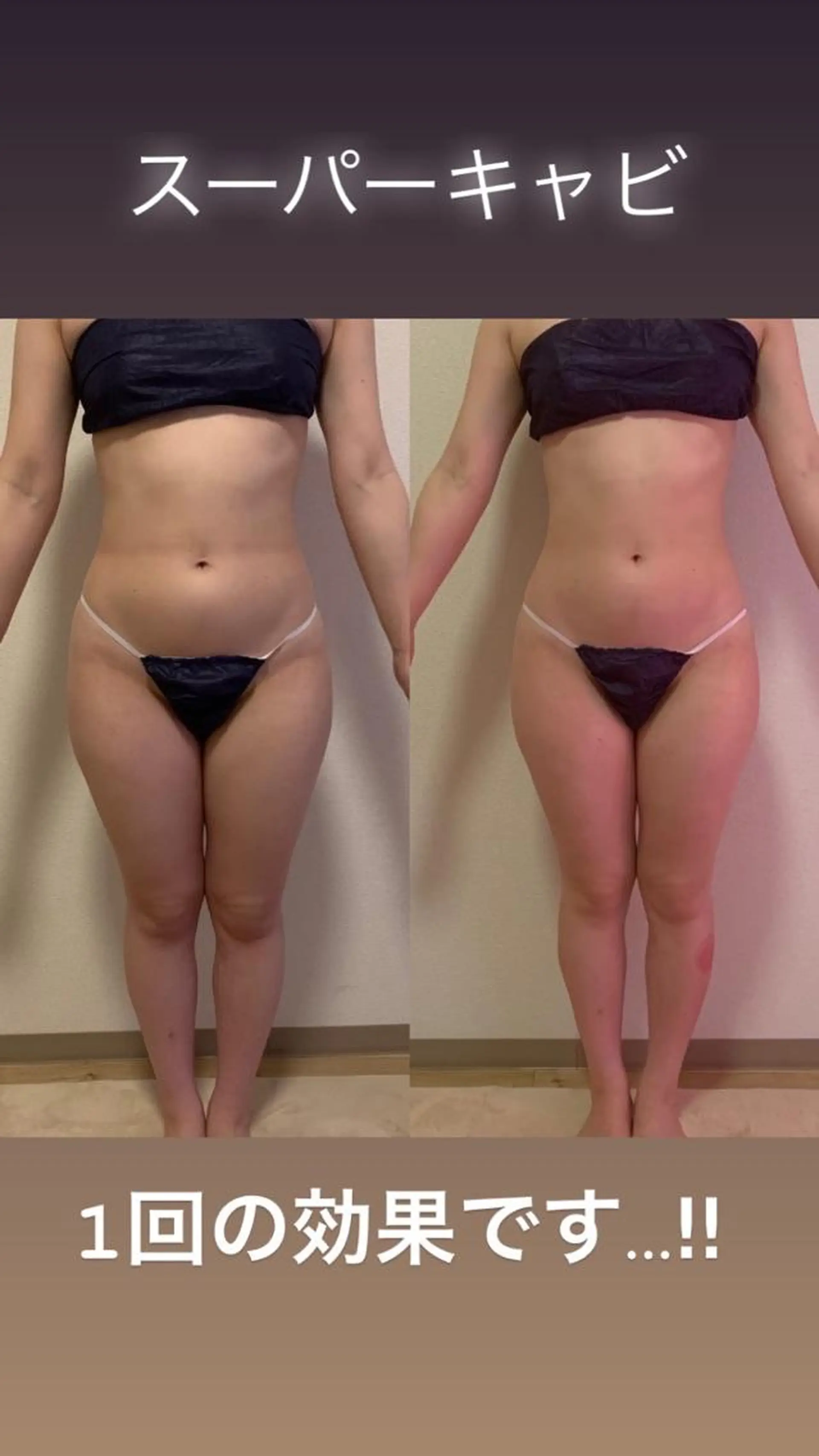 a  room salonのエステ・リラクイメージ