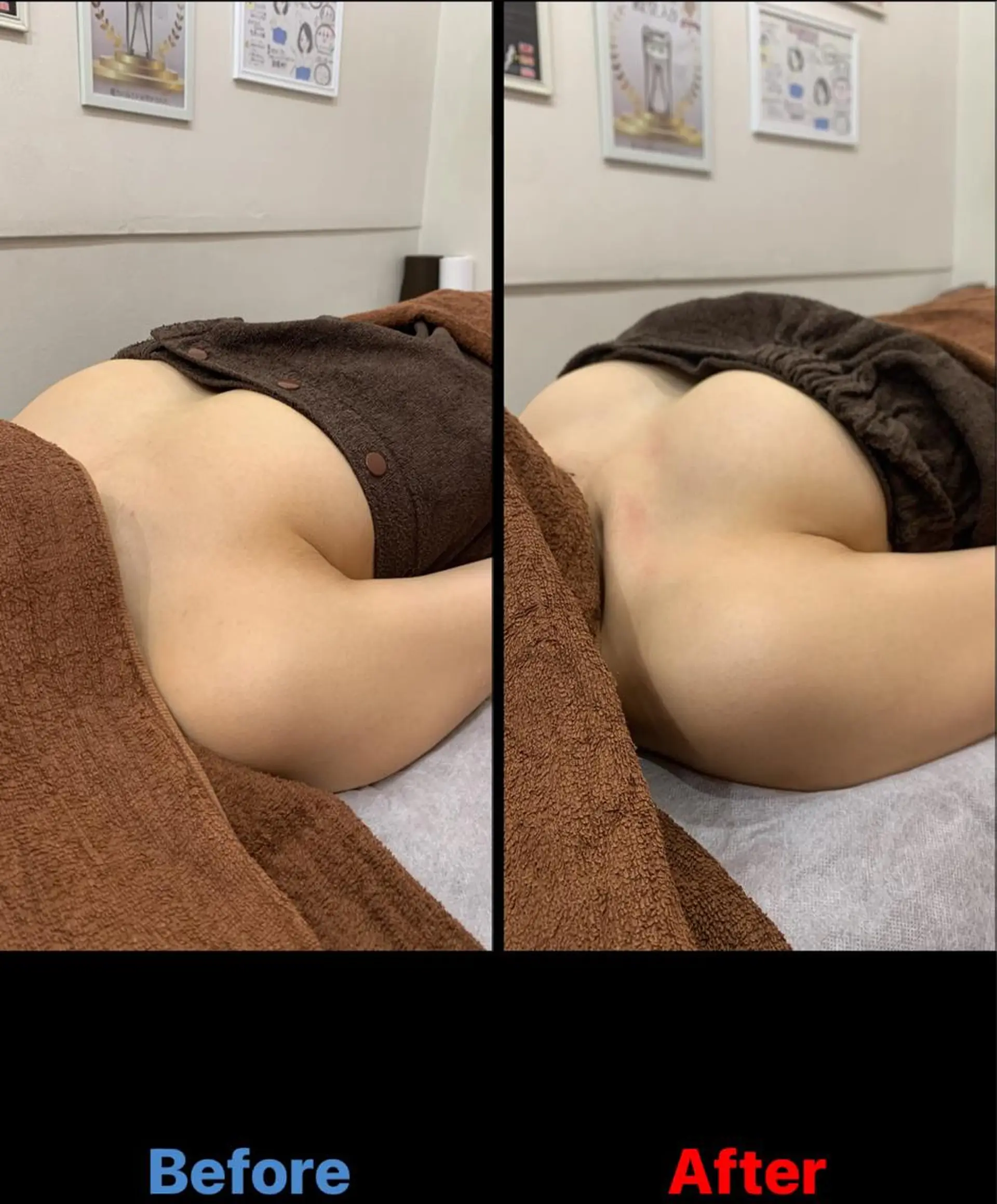 毛穴改善/脱毛 ネイル　川上久仁子のエステ・リラクイメージ