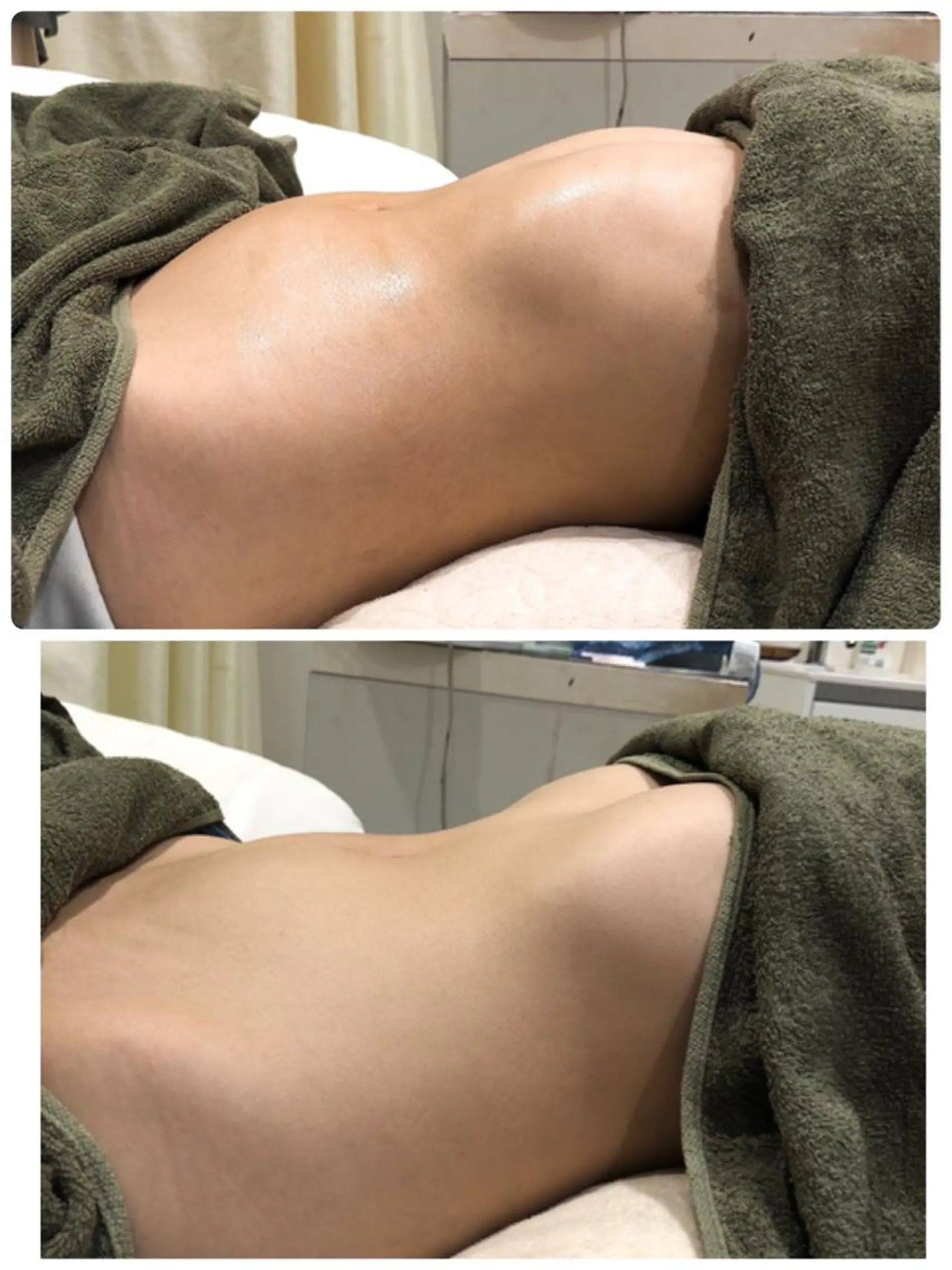 樋渡 侑希のヘアスタイル