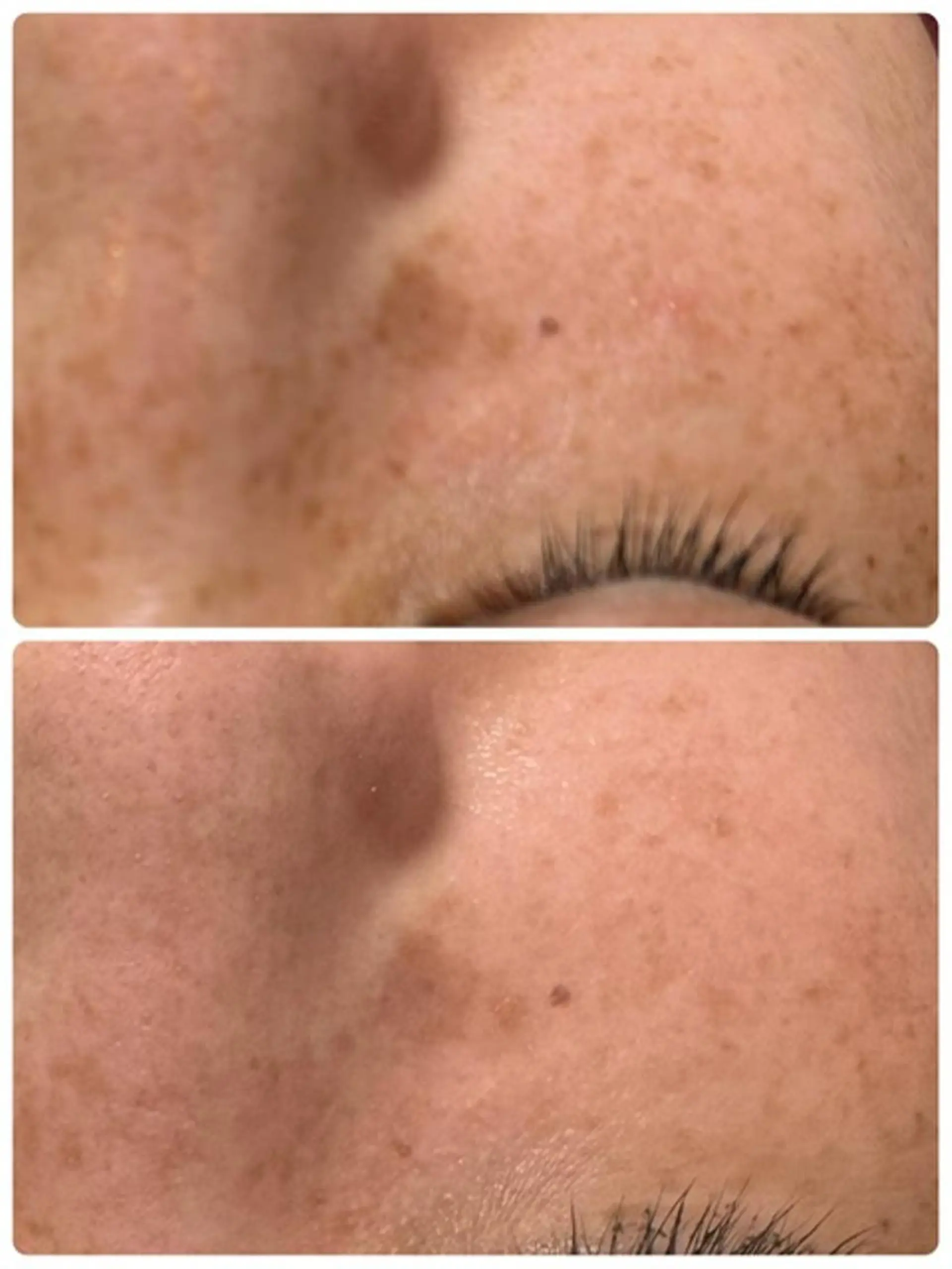 Lien オーナー　山口智嘉のエステ・リラクイメージ