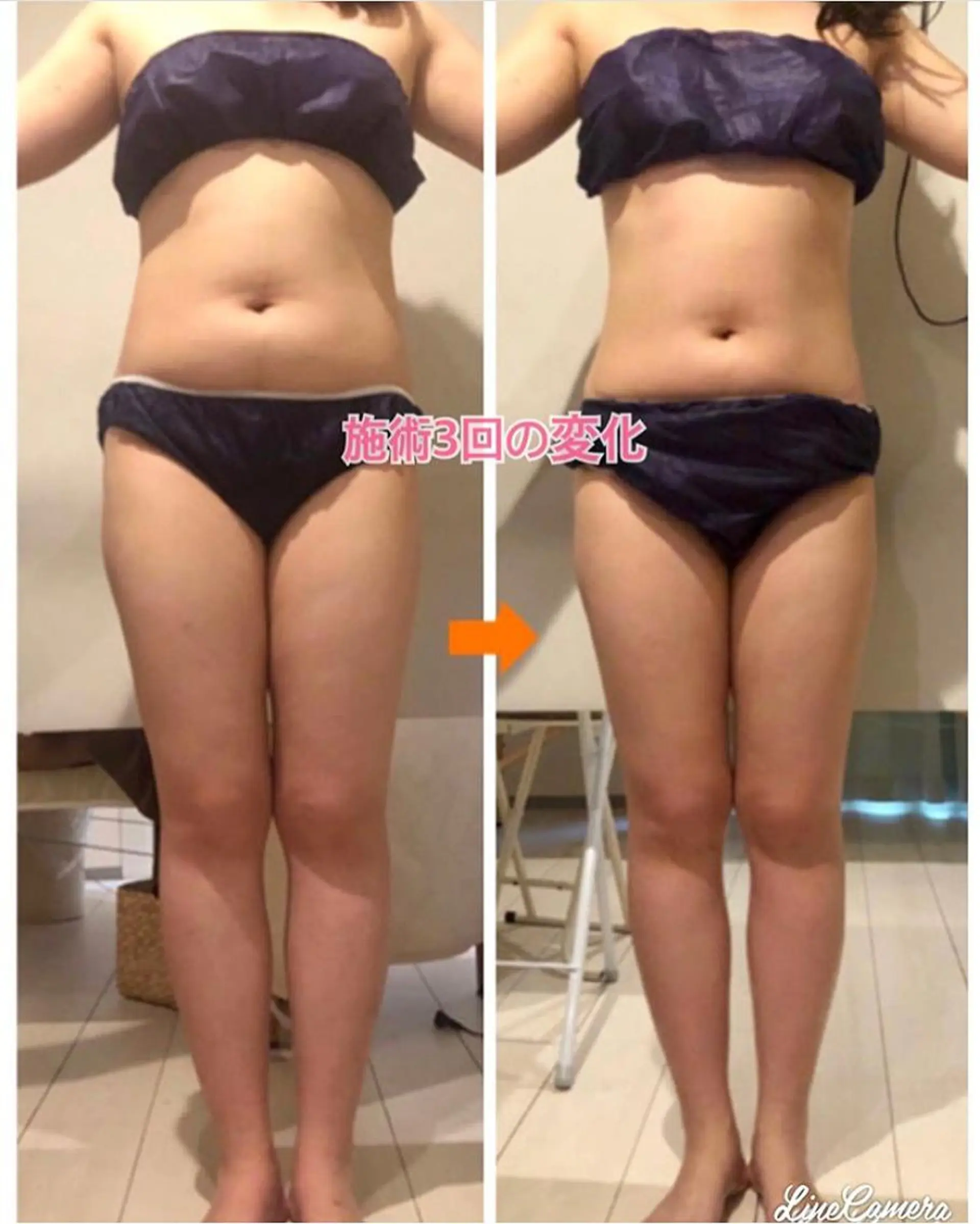 ショート カラー パーマ ヘアアレンジ メンズ キッズ ネイル マツエク・マツパ エステ リラク ‍痩身＆ボディ 結果出し🌟丹野のエステ・リラクイメージ