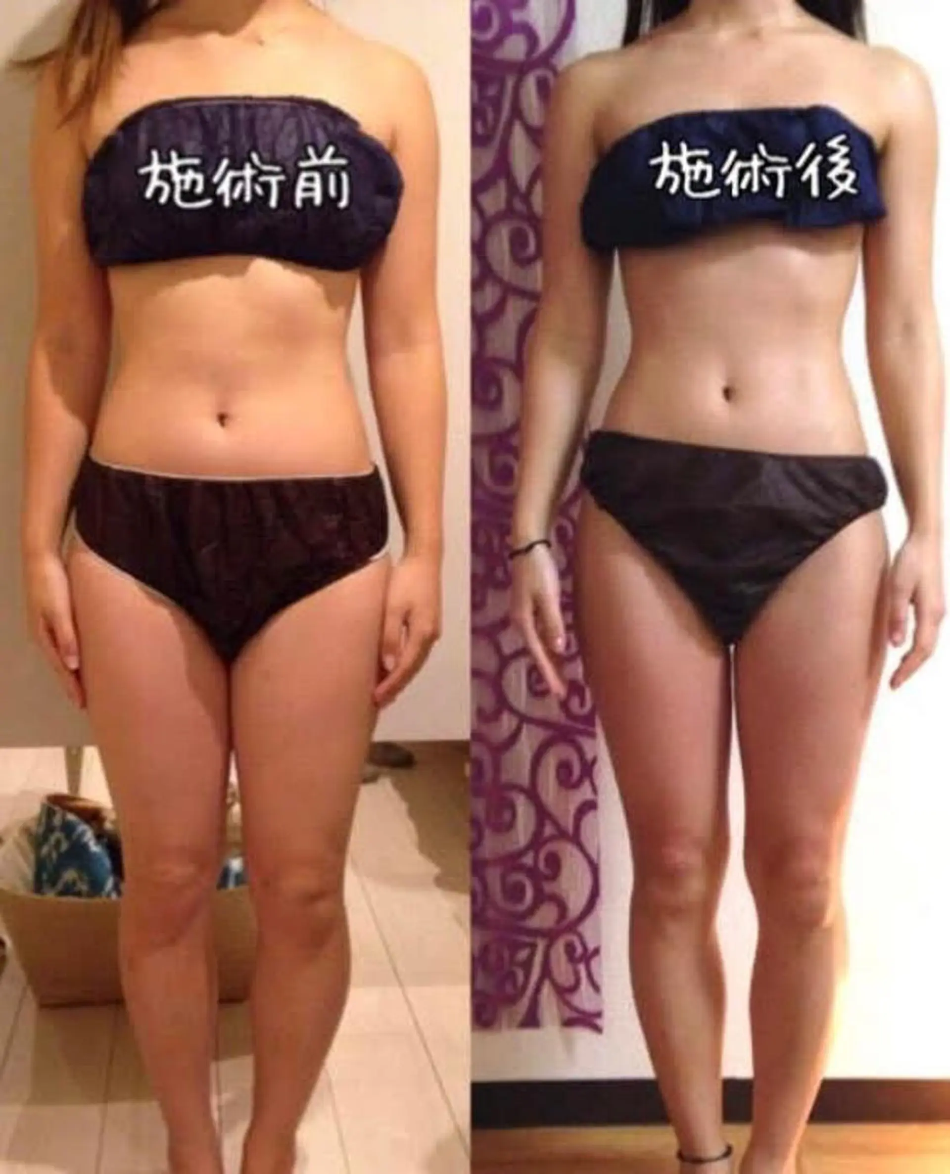 ショート カラー パーマ ヘアアレンジ メンズ キッズ ネイル マツエク・マツパ 強圧オールハンド痩身&黄土よもぎ蒸しプライベートサロンClematis池袋所属・強圧オールハンド痩身 片野のエステ・リラクイメージ