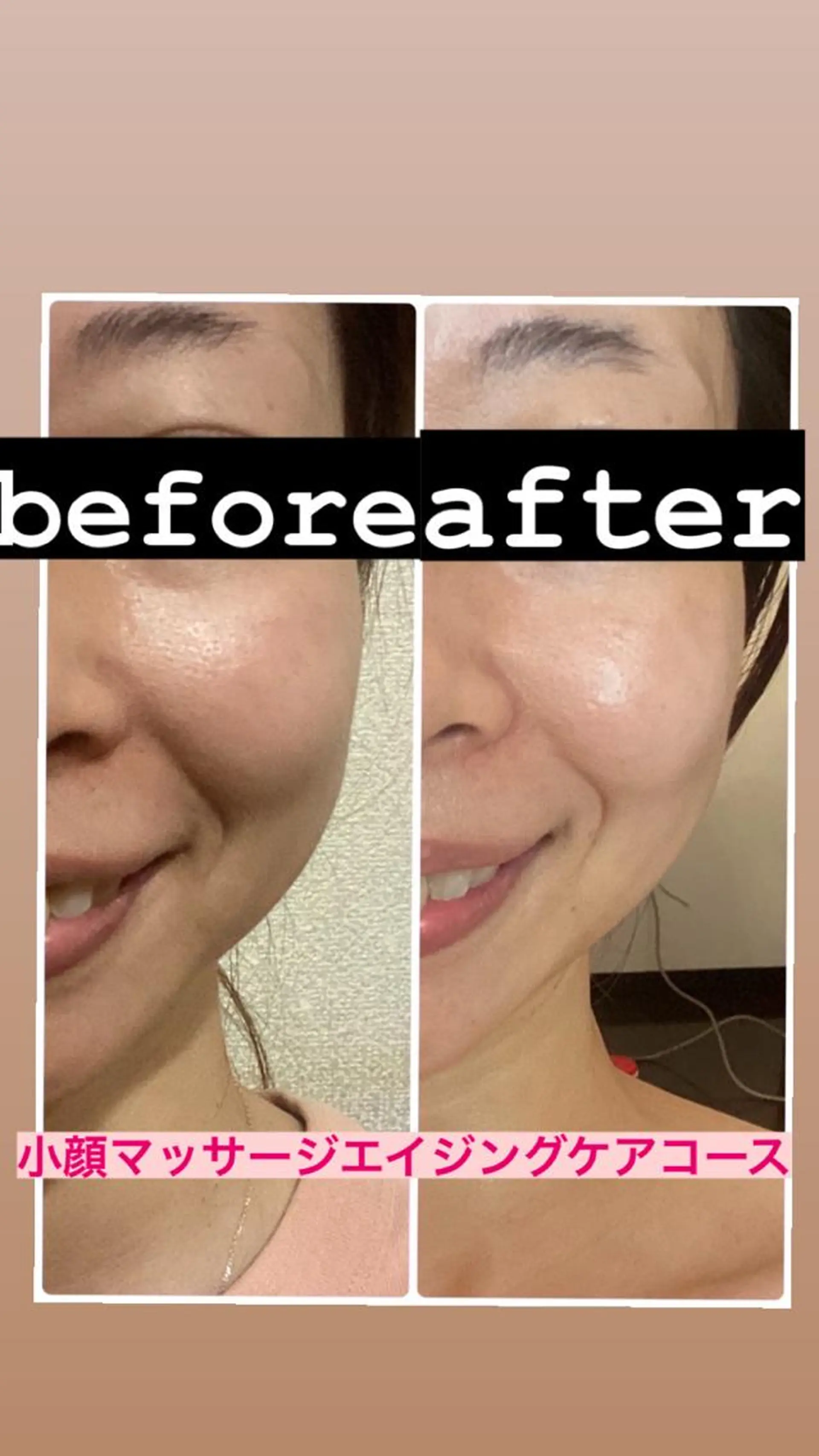 脱毛・エステサロン LuLuNのエステ・リラクイメージ