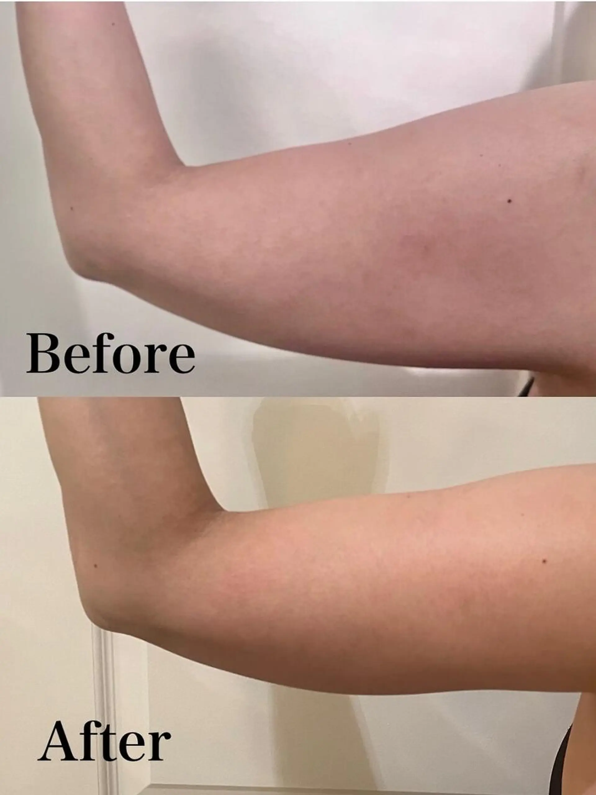 エステ リラク 痩身ハイパーナイフ 小顔フェイシャル痩身のエステ・リラクイメージ