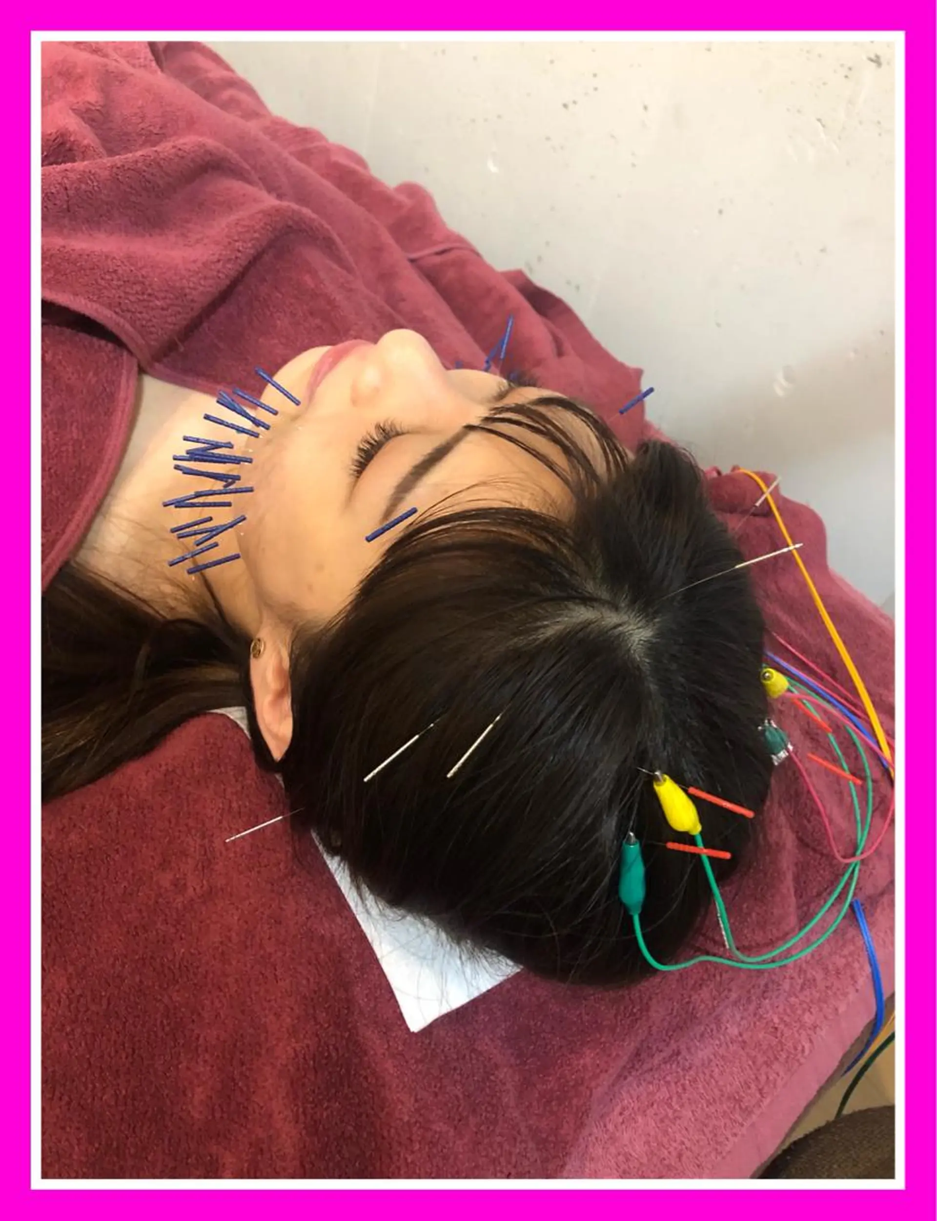 美容鍼灸女性専用 りんご鍼灸治療院のエステ・リラクイメージ