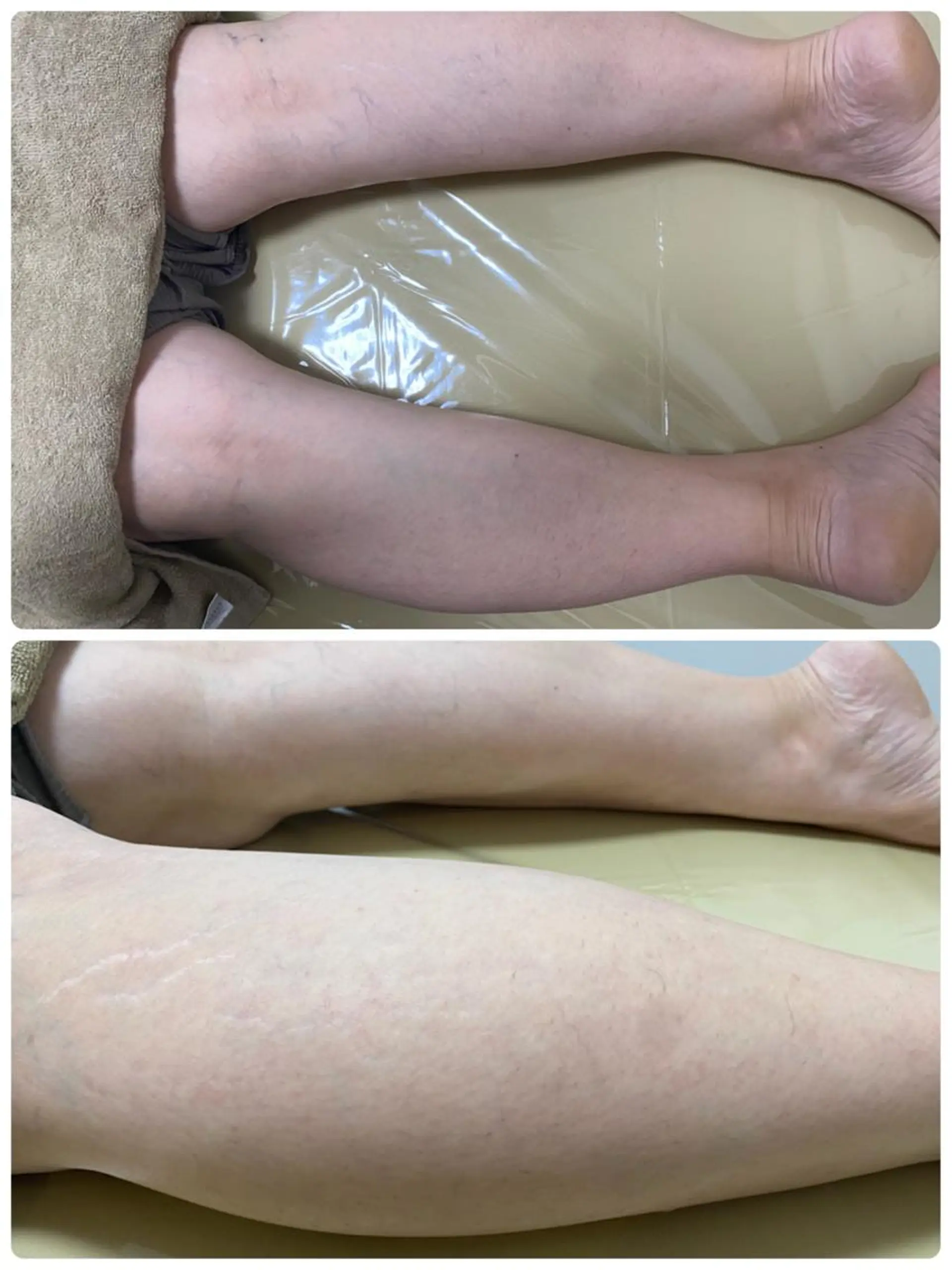 女性専用脱毛サロン エンジェルナンバーのエステ・リラクイメージ