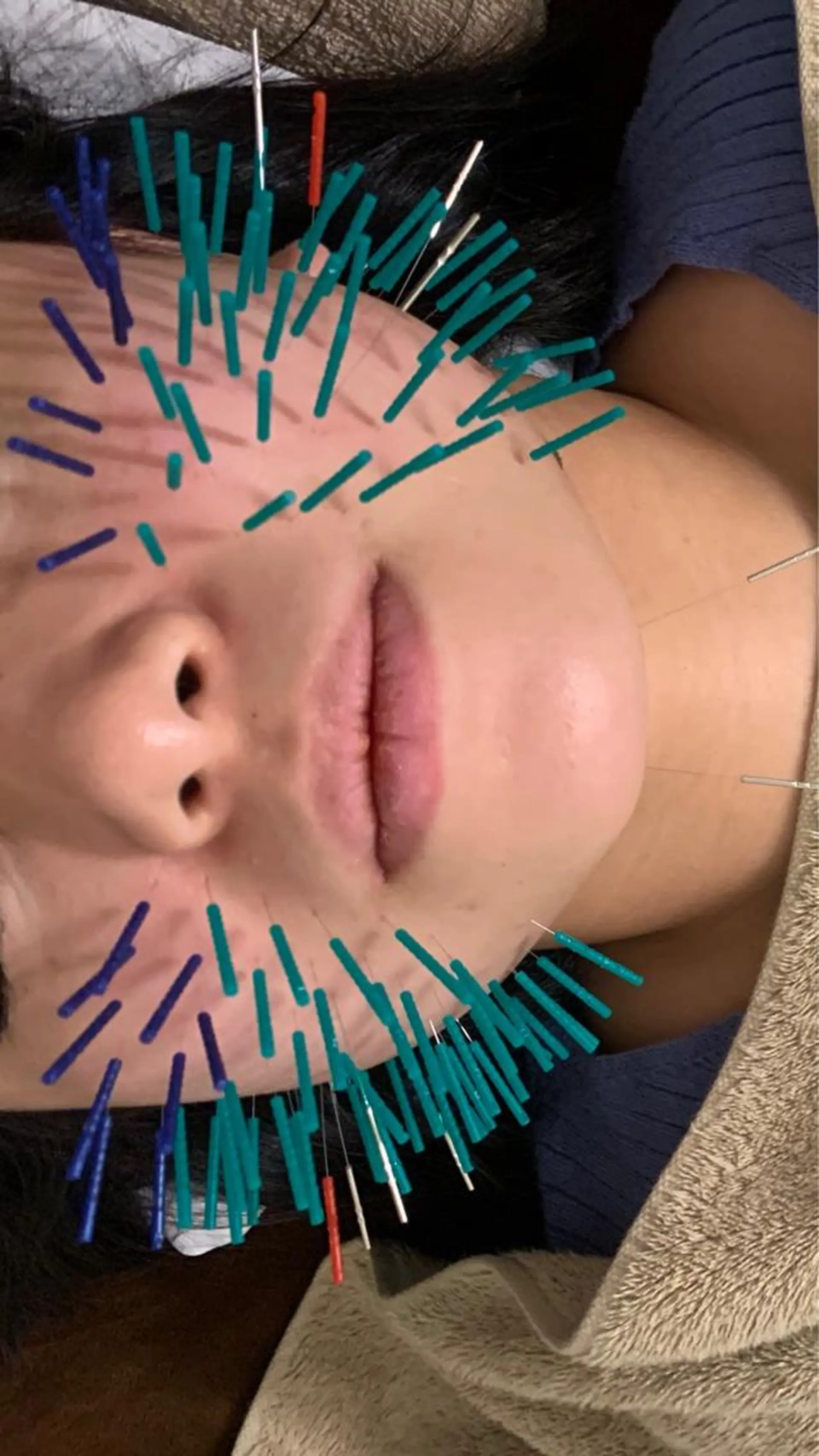 表参道鍼灸院K 美容鍼🔮ララピールのエステ・リラクイメージ