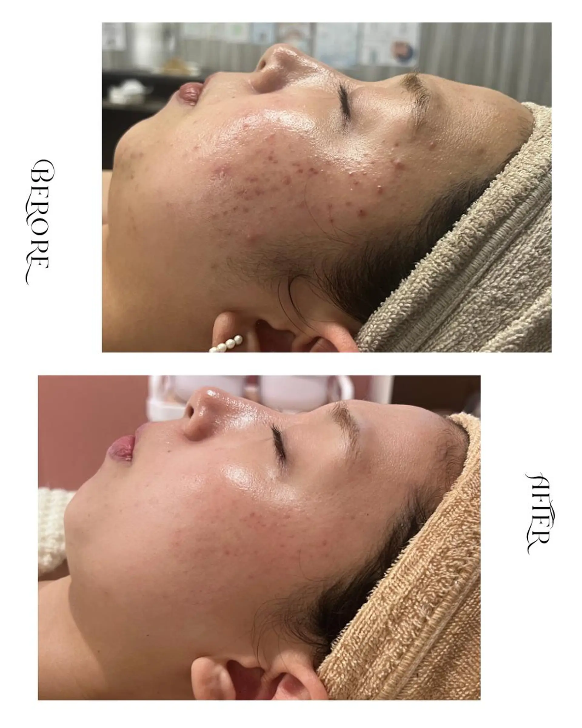 脱毛・肌質改善サロン Linoのエステ・リラクイメージ