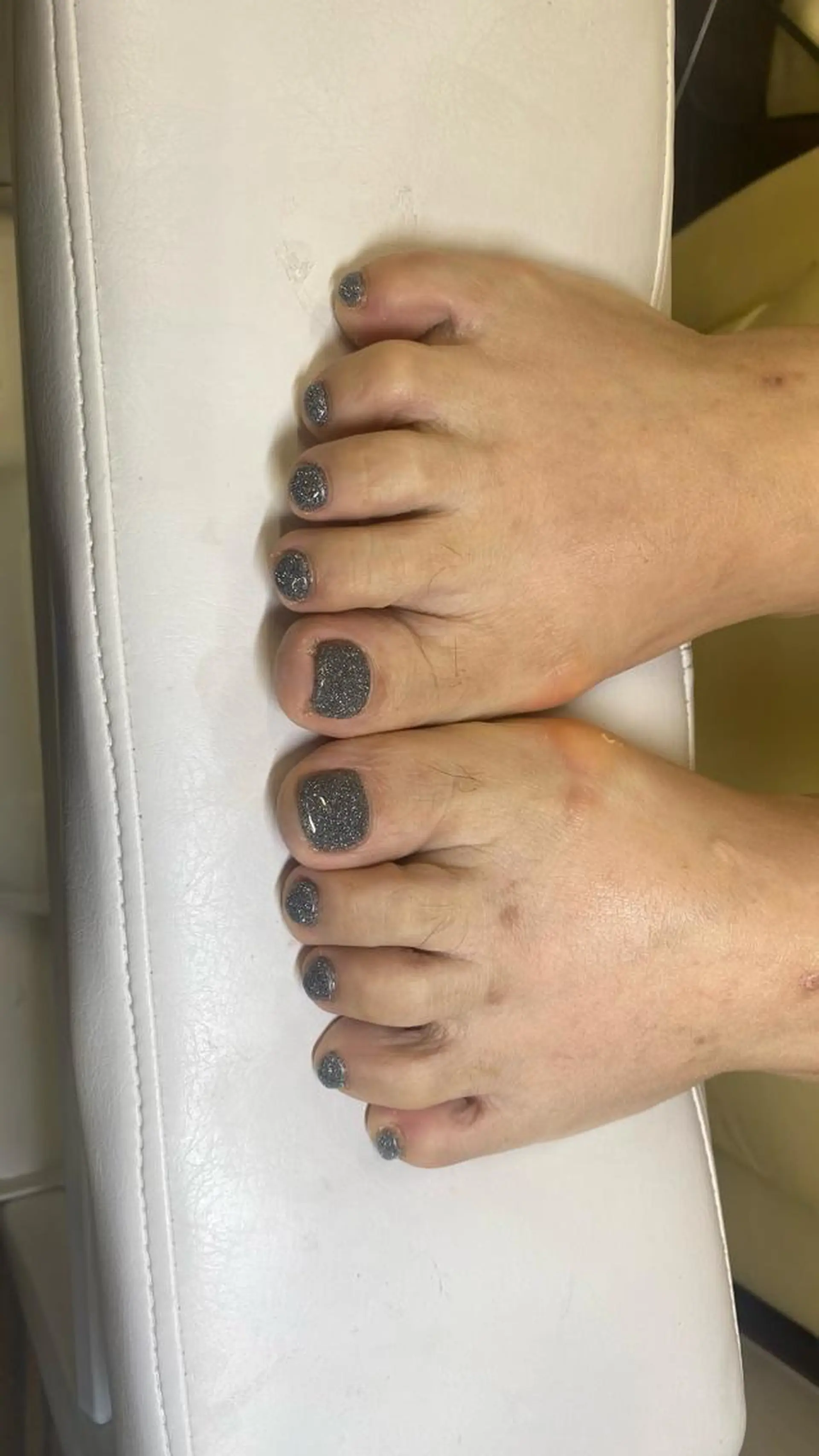 ネイル アイエスト所属・EYEST クロダのネイルデザイン