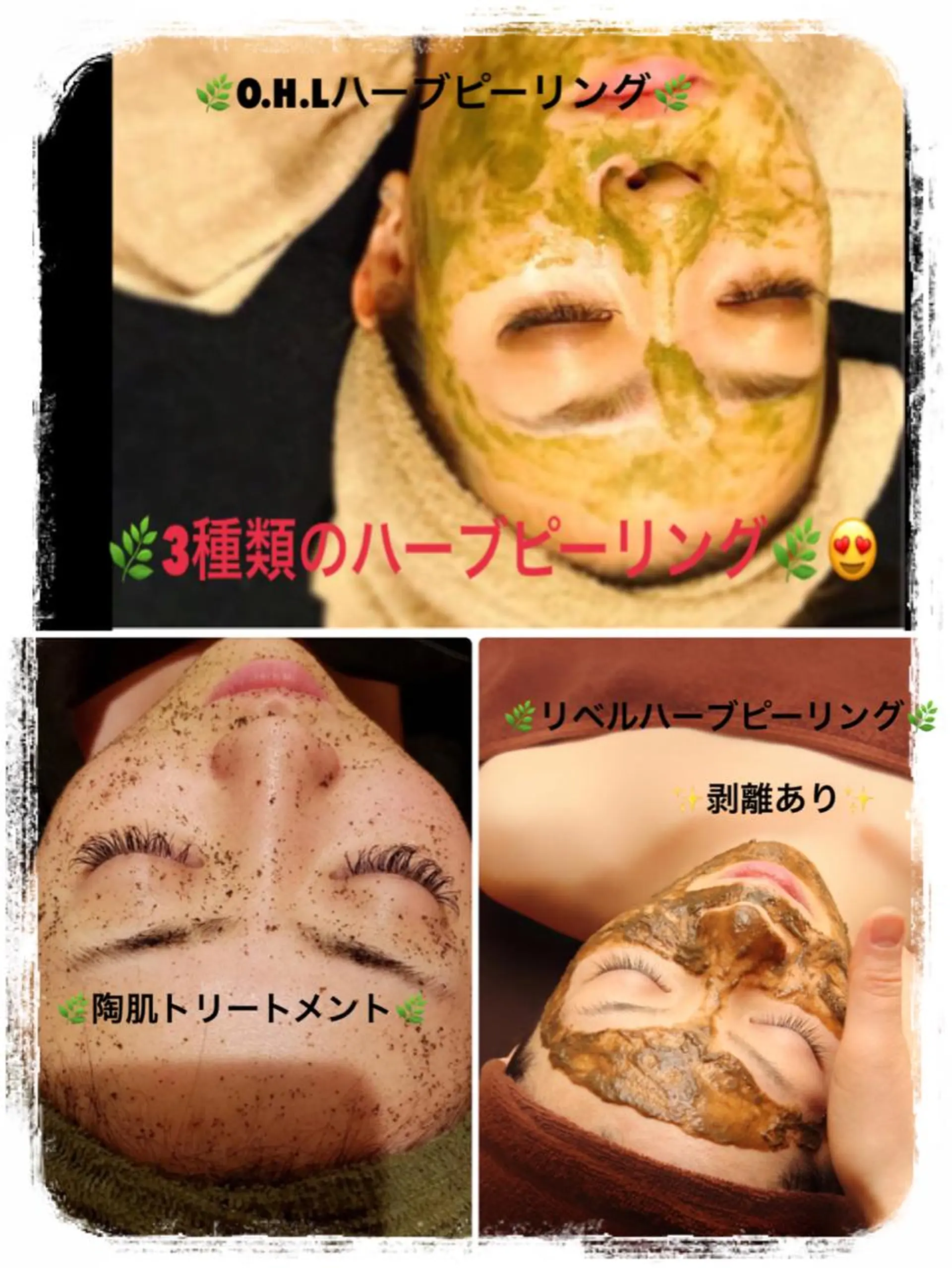 エステ 【リベルハーブピーリング認定店】敏感肌・美白脱毛専門店Dione立川店所属・Dione 立川店のエステ・リラクイメージ