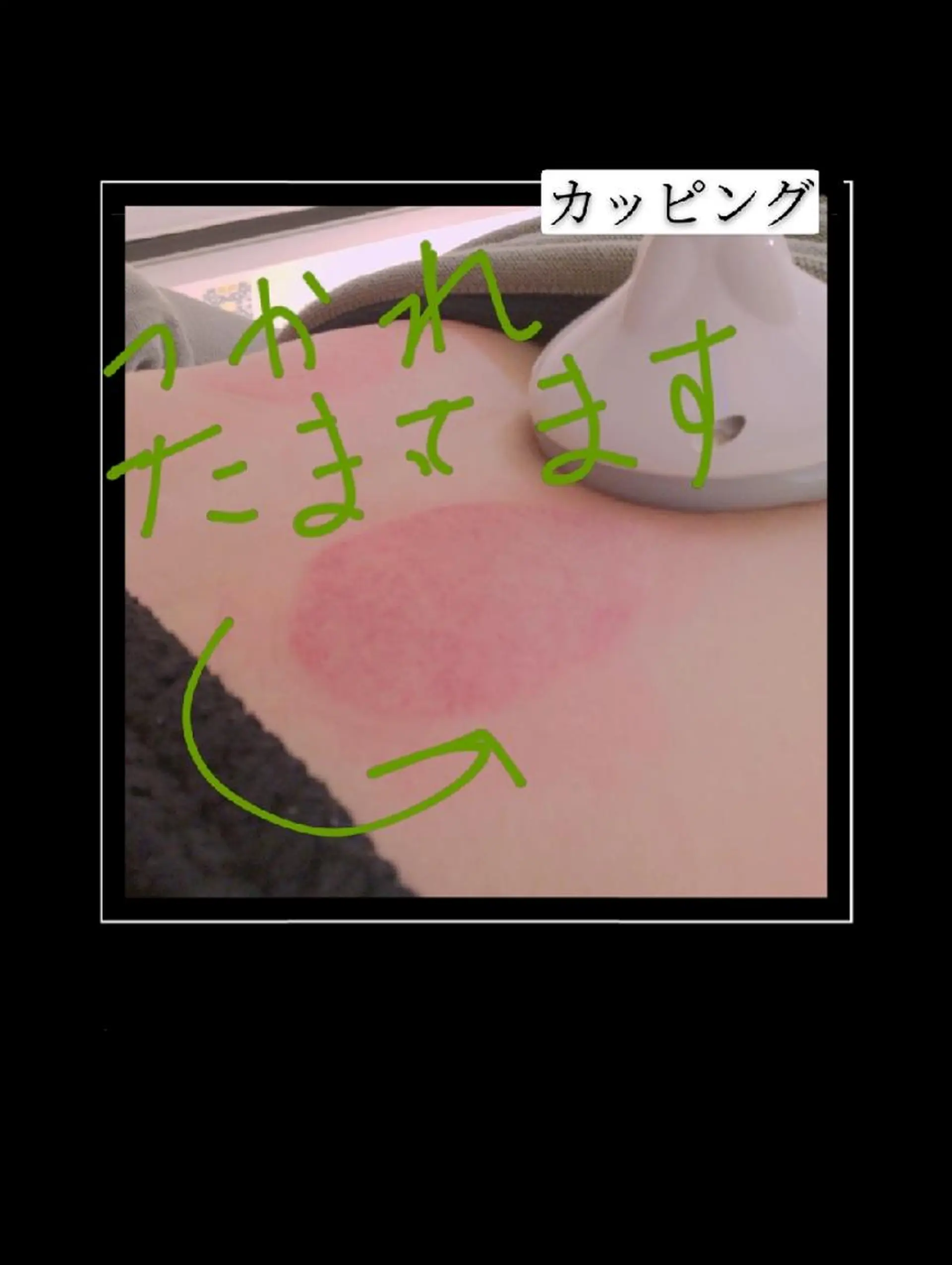 🅖🅤🅩🅔🅛 salonのエステ・リラクイメージ