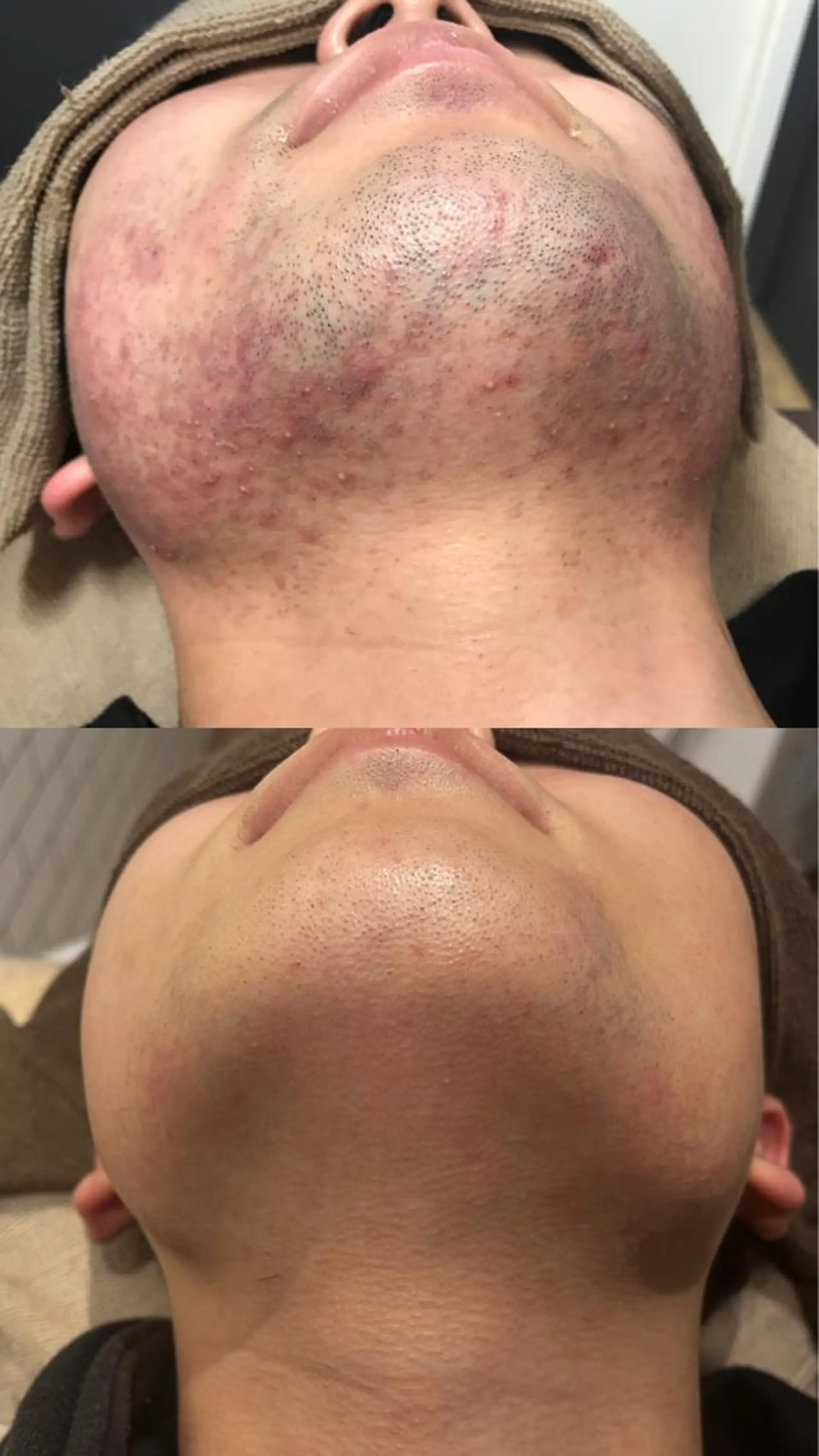 脱毛 Lilyboo 池袋のエステ・リラクイメージ