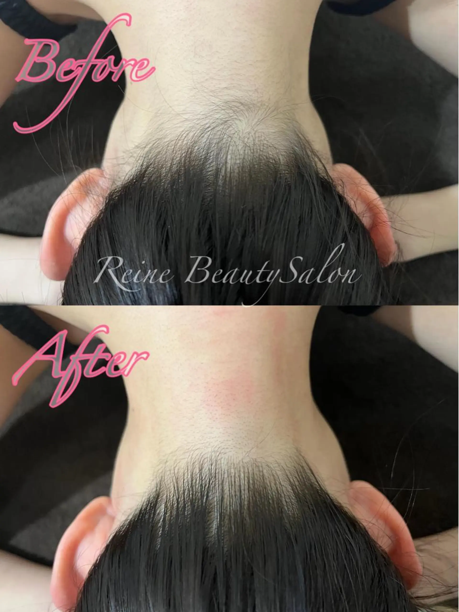 Reine BeautySalon所属・毛穴/シミ肝斑/脱毛 横山梨里のエステ・リラクイメージ