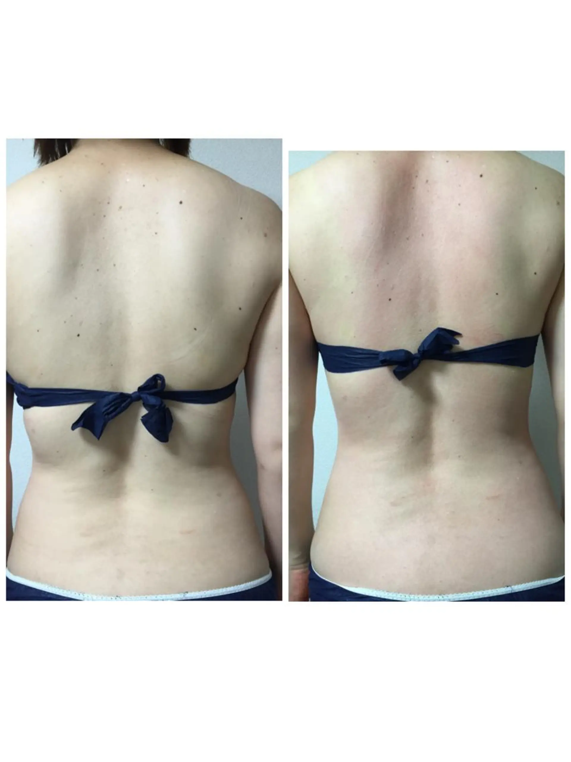 横浜ビューティーファクトリーHANA元町店所属・エステ＆アロマ HANAのエステ・リラクイメージ