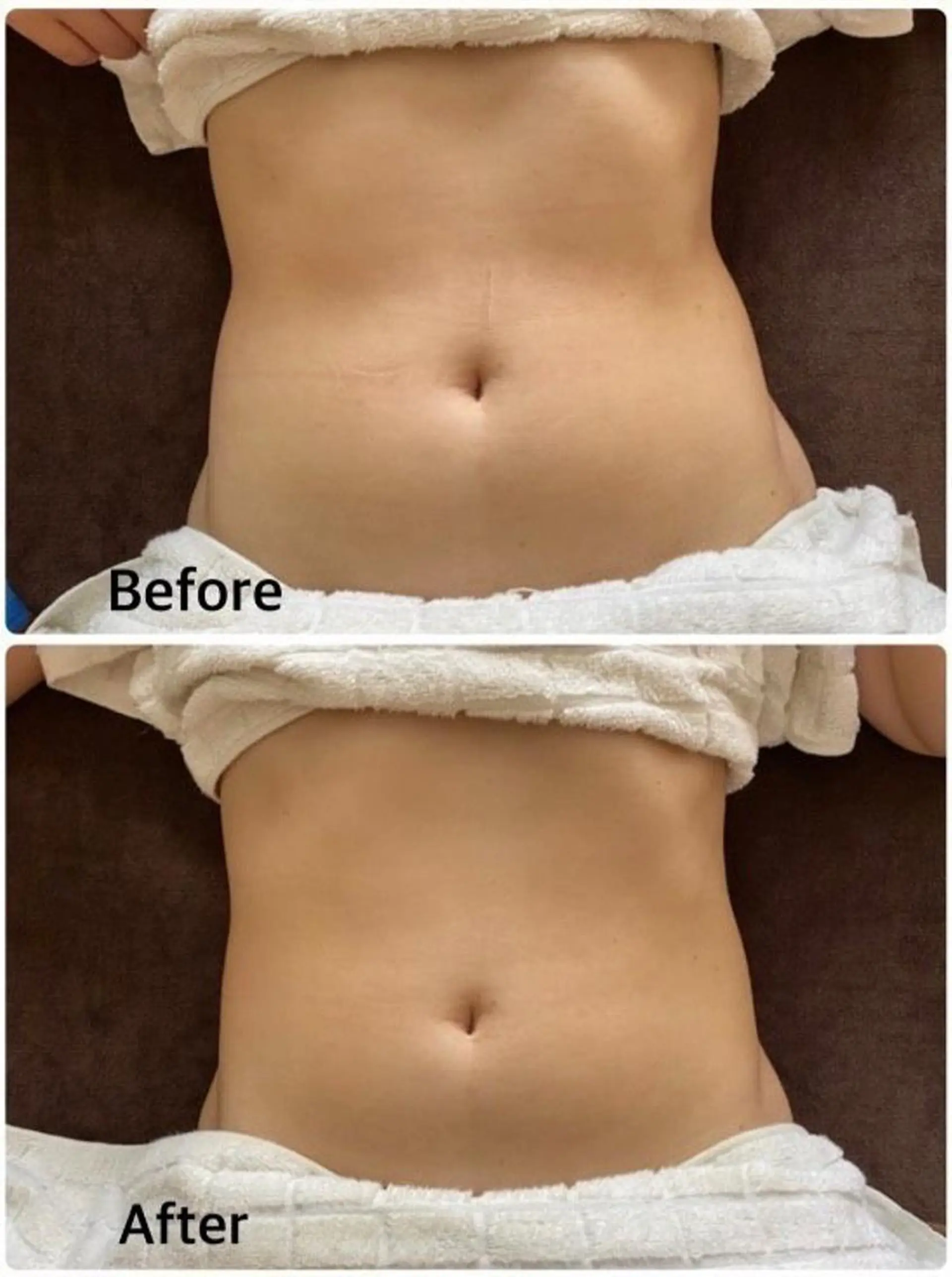 Salon Rosé 🌿漢方🌿足痩せのエステ・リラクイメージ