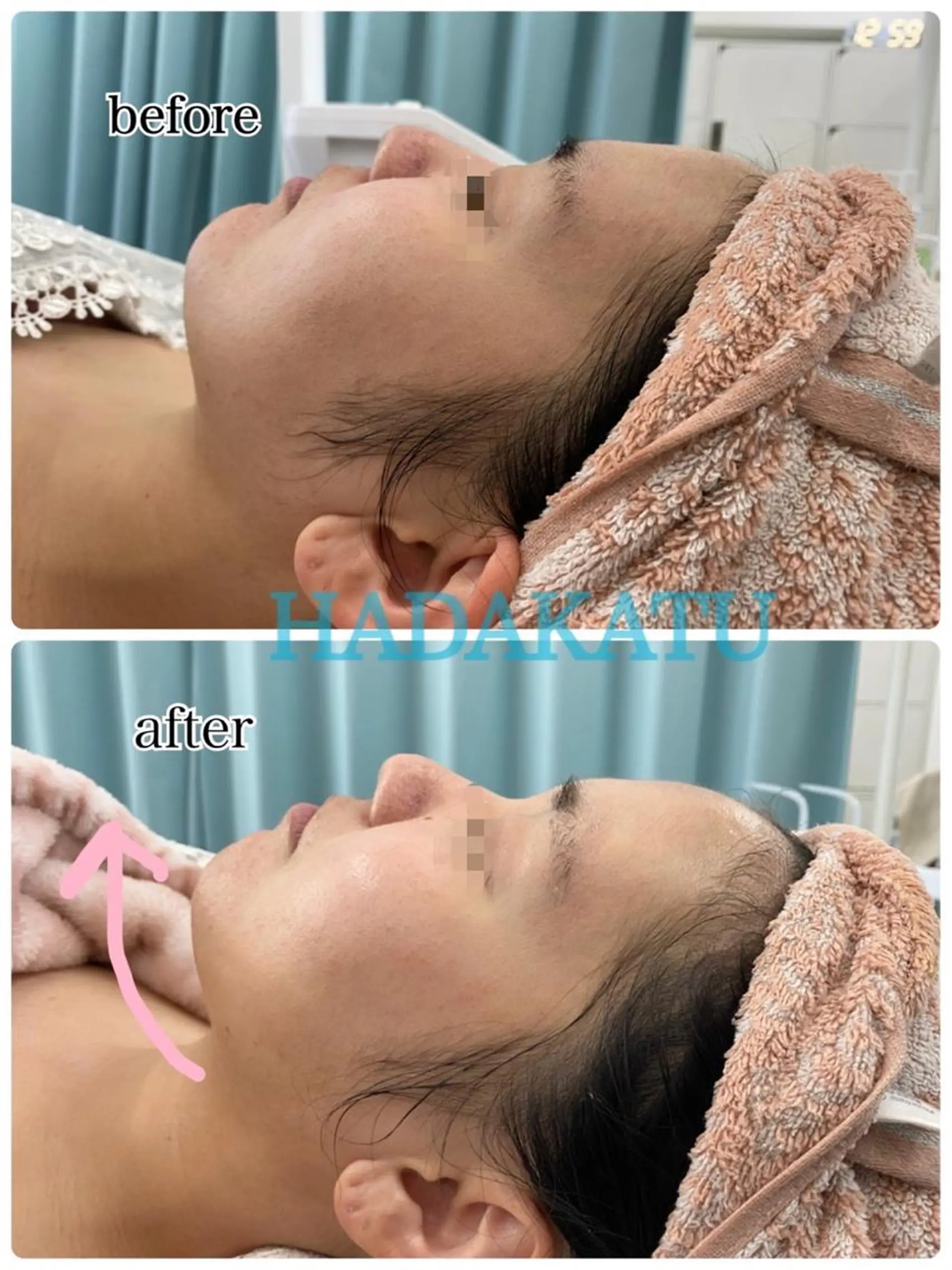 総合エステサロン 肌活のエステ・リラクイメージ