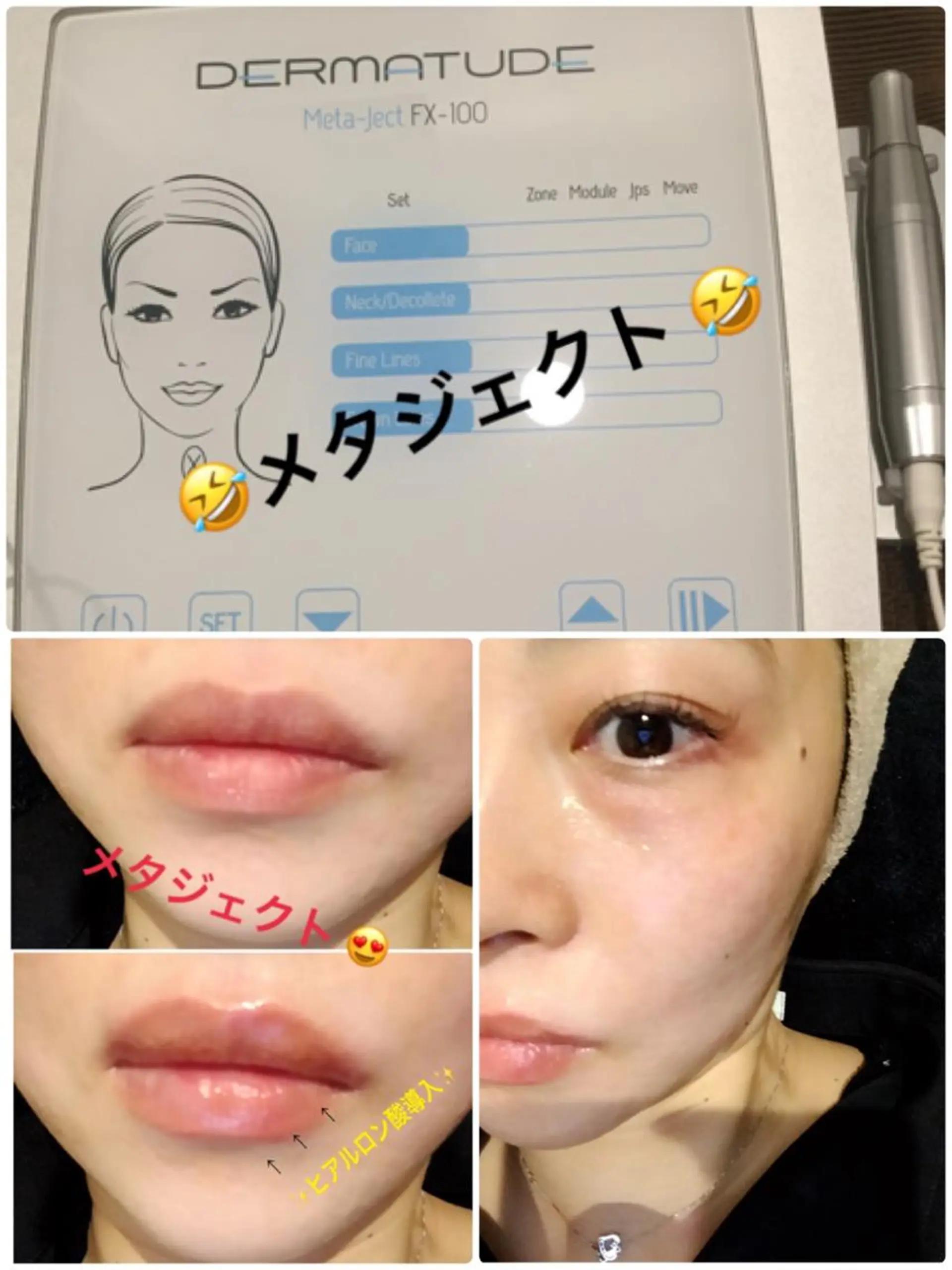 【リベルハーブピーリング認定店】敏感肌・美白脱毛専門店Dione立川店所属・Dione 立川店のエステ・リラクイメージ