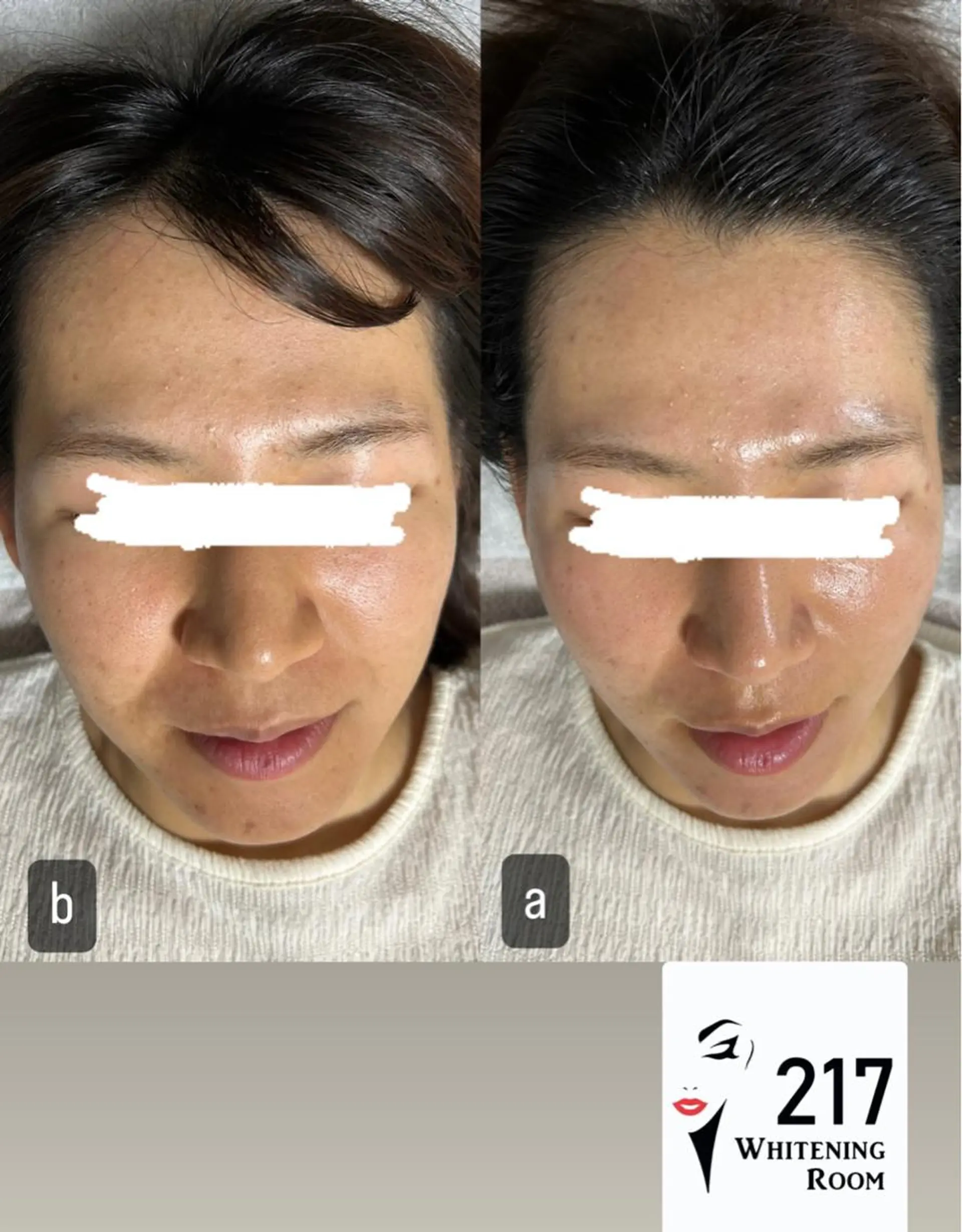 217whitening  room所属・217 ホワイトニングルームのエステ・リラクイメージ