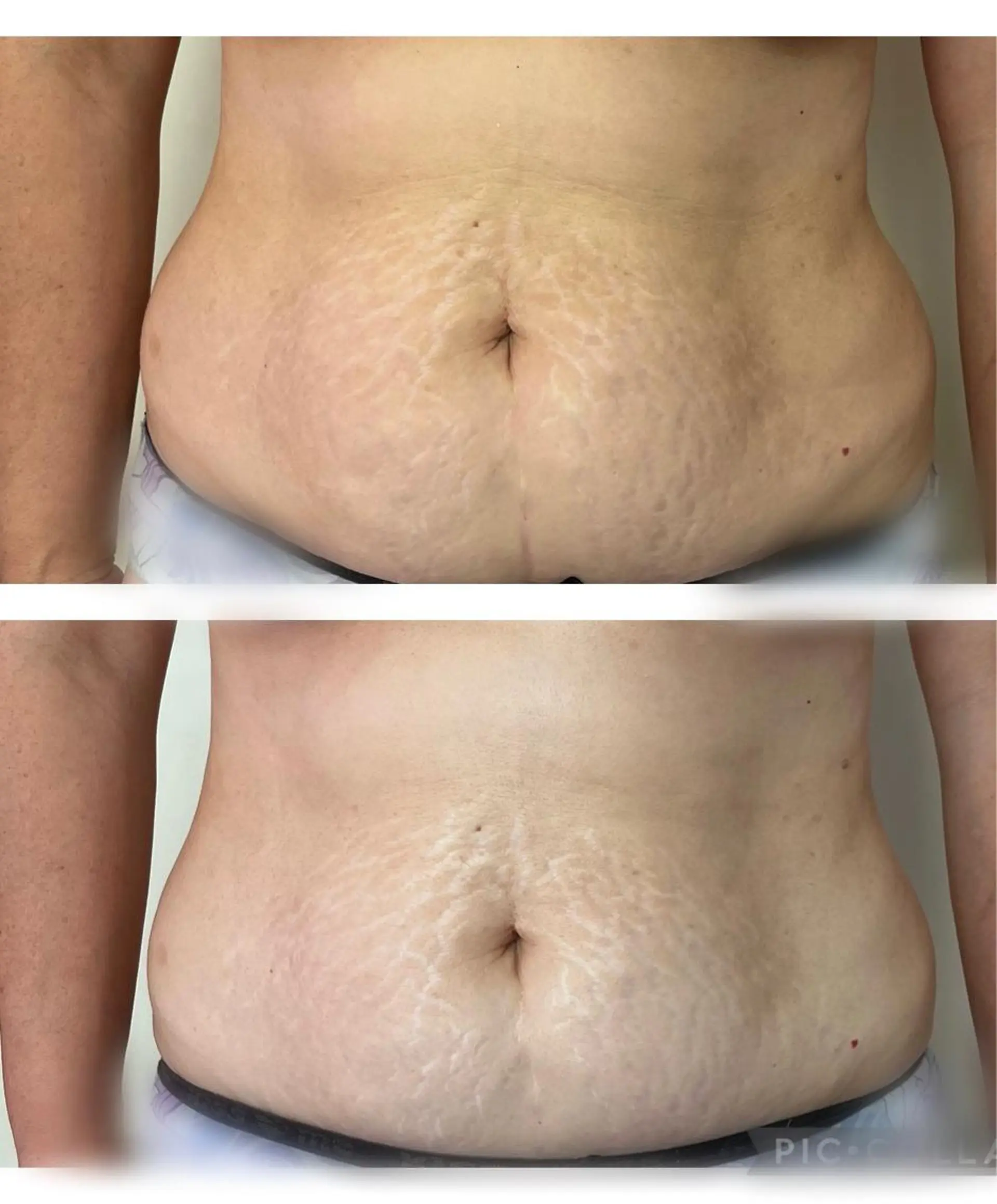 エステ リラク marrina terraceのその他イメージ