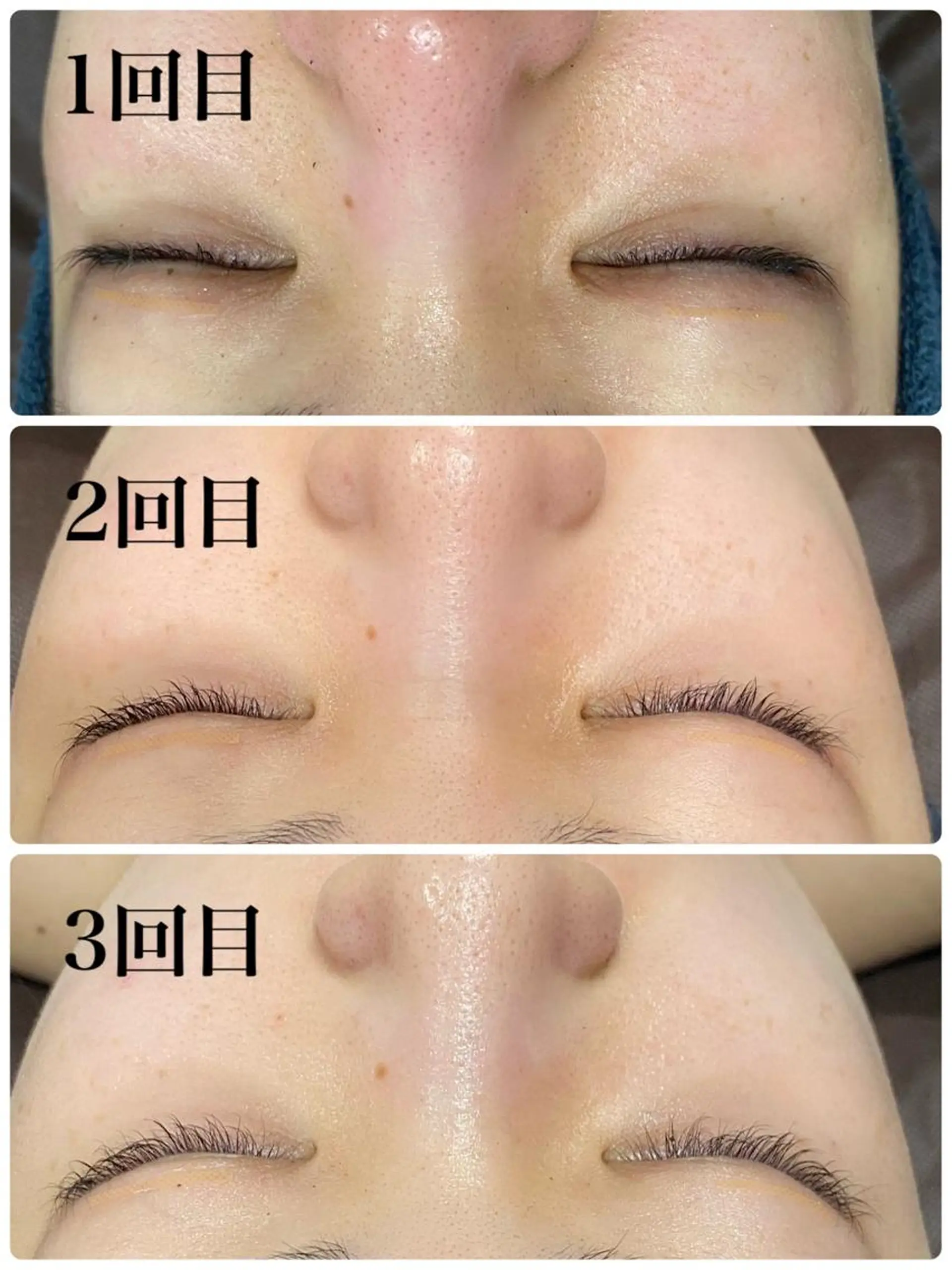 ハーブピーリング専門店 Ribboｰn所属・川田 弥生のエステ・リラクイメージ