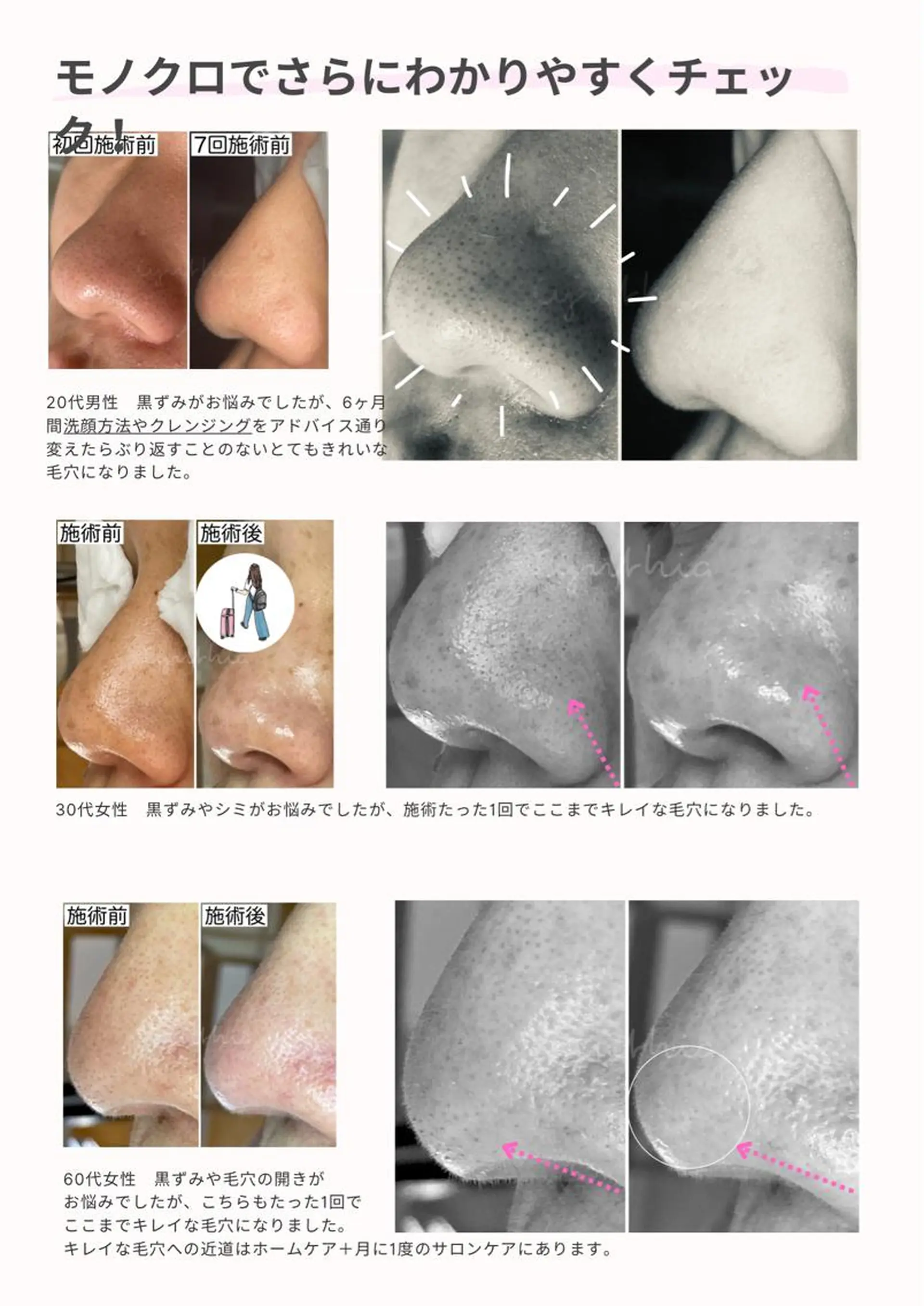 メンズ エステ 毛穴ケア専門店 Cynthiaのエステ・リラクイメージ