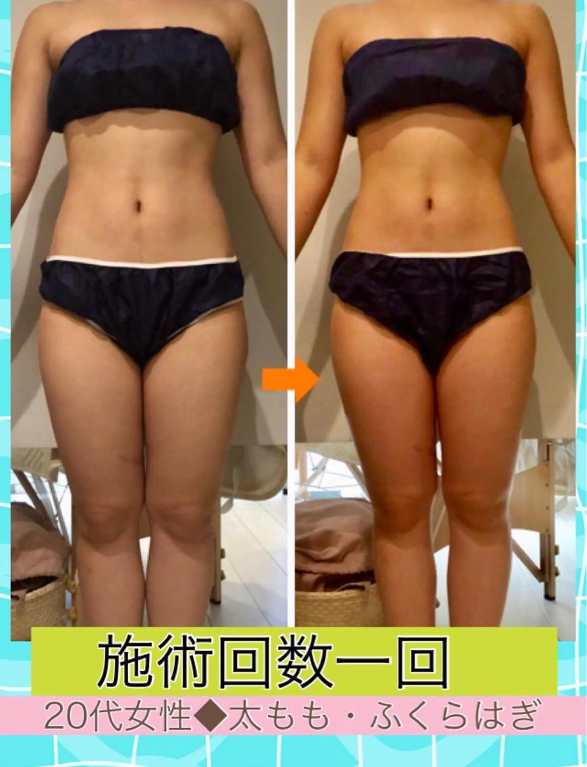 ロング カラー パーマ ヘアアレンジ メンズ キッズ ネイル マツエク・マツパ ‍痩身＆ボディ 結果出し🌟丹野のエステ・リラクイメージ