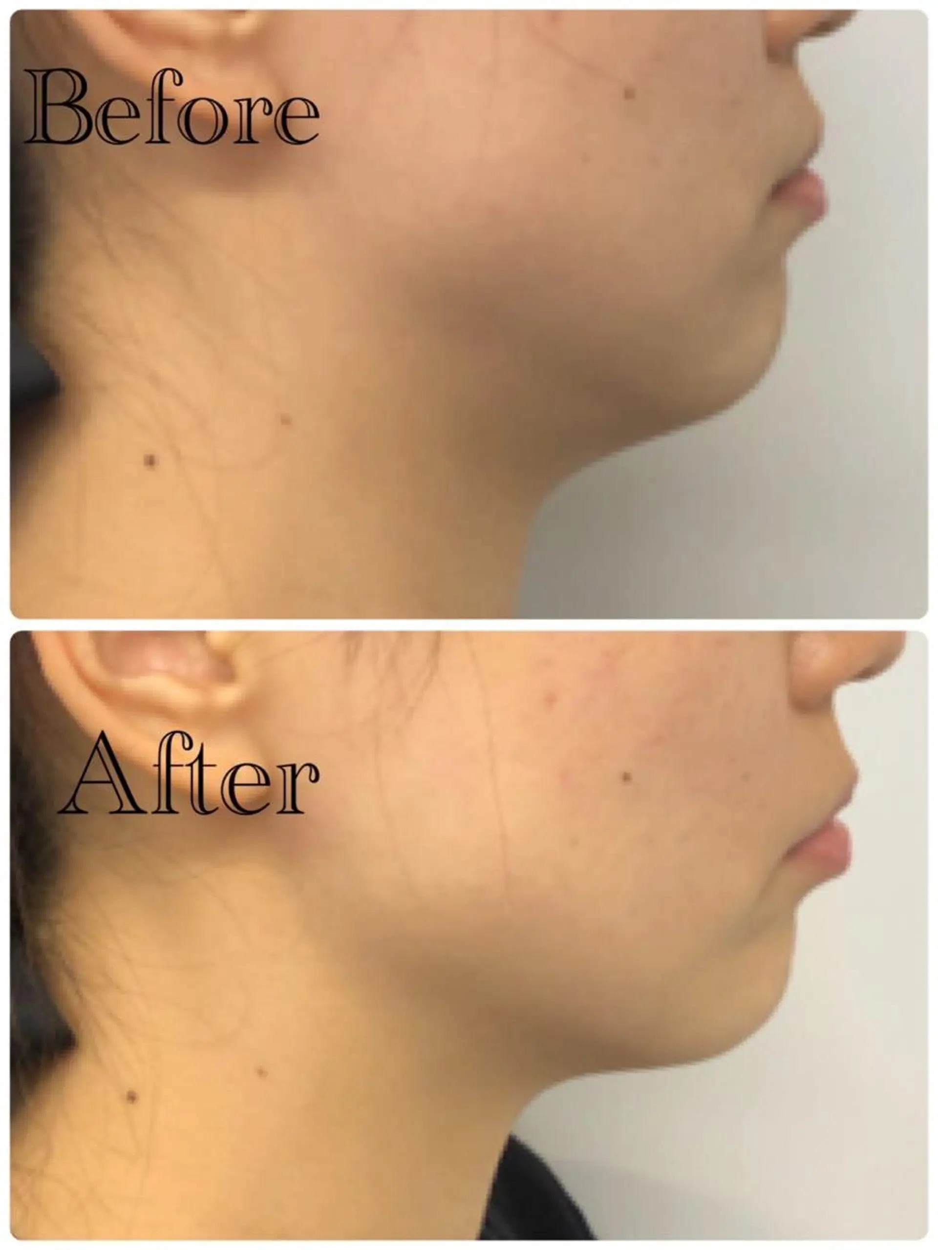 エステ 姿勢改善&beauty salon LAUB所属・姿勢改善 サロンLAUB奥村のエステ・リラクイメージ