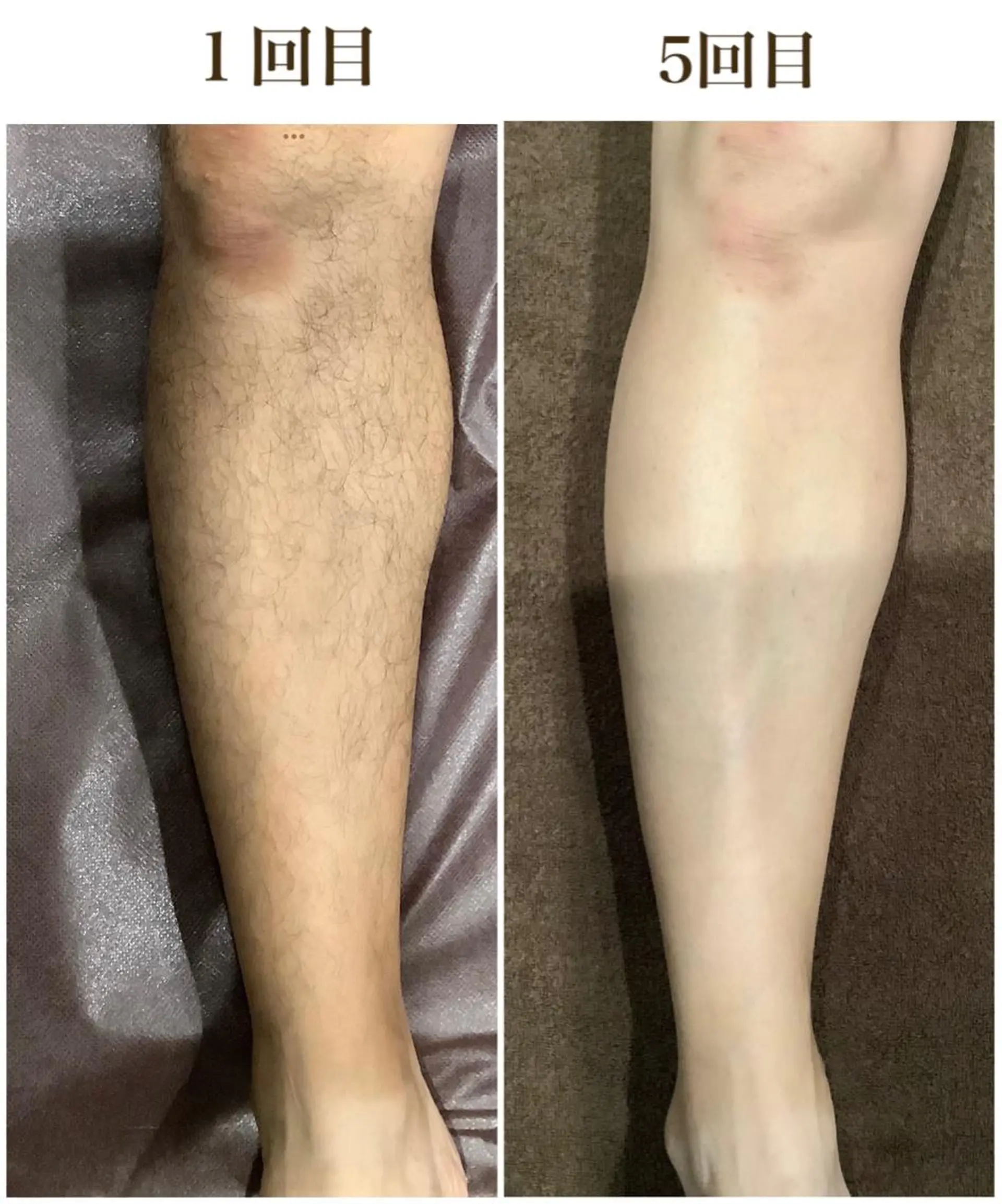 メンズ サロンボーテアネラ燕三条所属・サロンボーテアネラ 燕三条のエステ・リラクイメージ