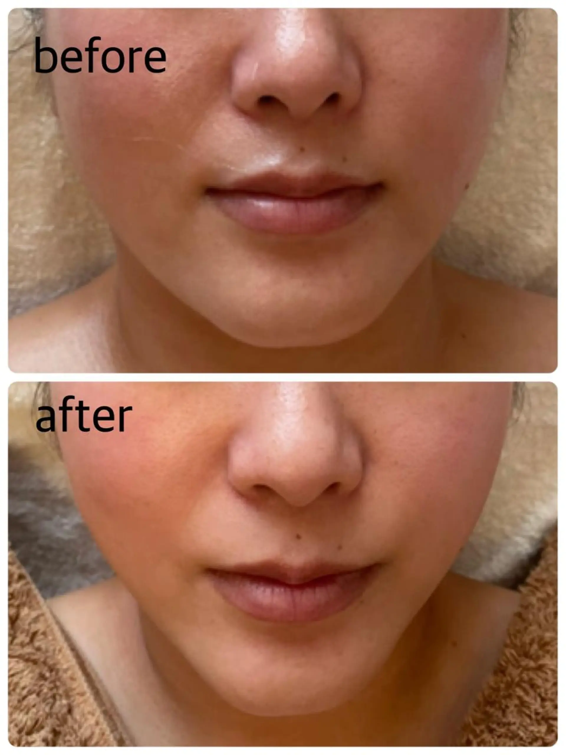 メナードフェイシャルサロン岐阜桜通所属・大橋 あつこのエステ・リラクイメージ