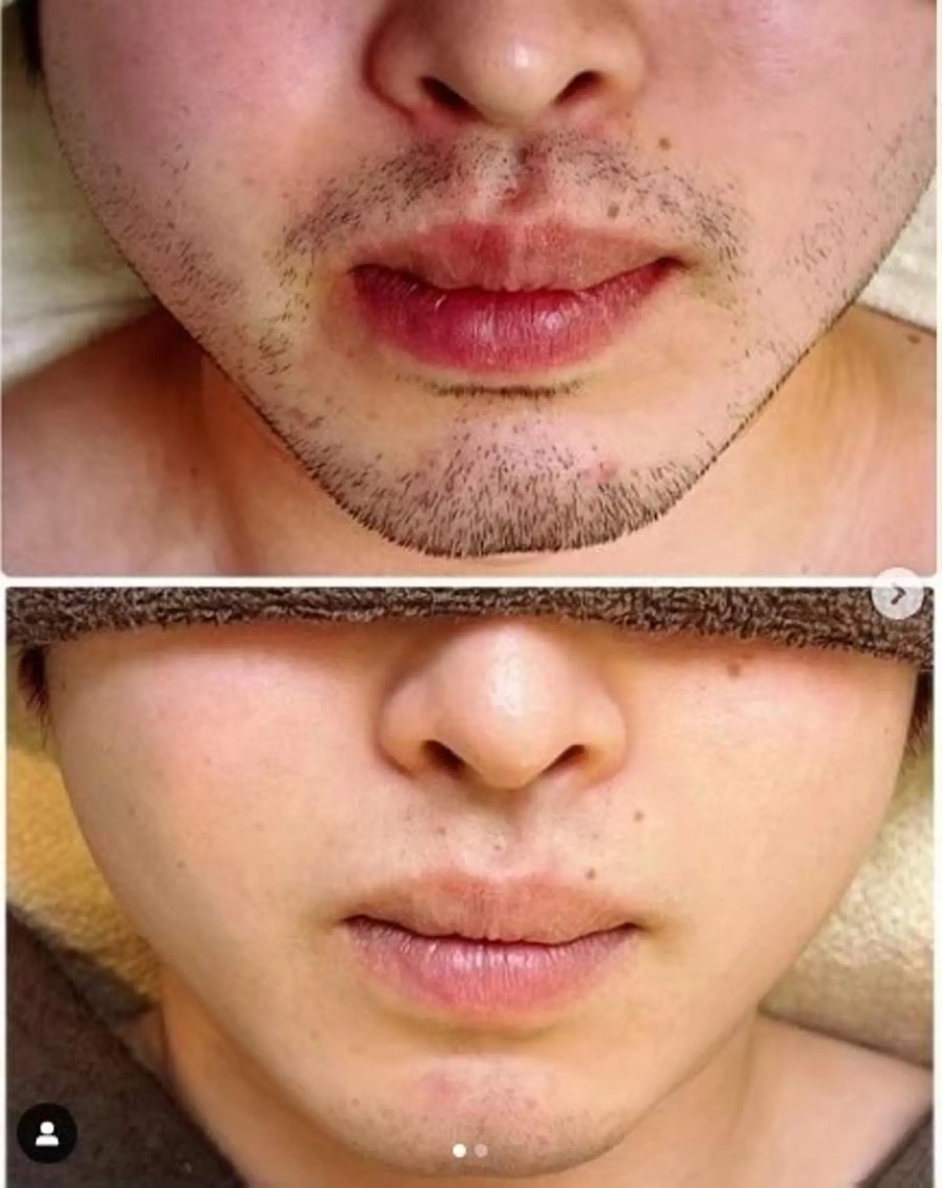 メンズ アルカンジュ~archange~所属・痩身/毛穴洗浄/脱毛 アルカンジュのエステ・リラクイメージ