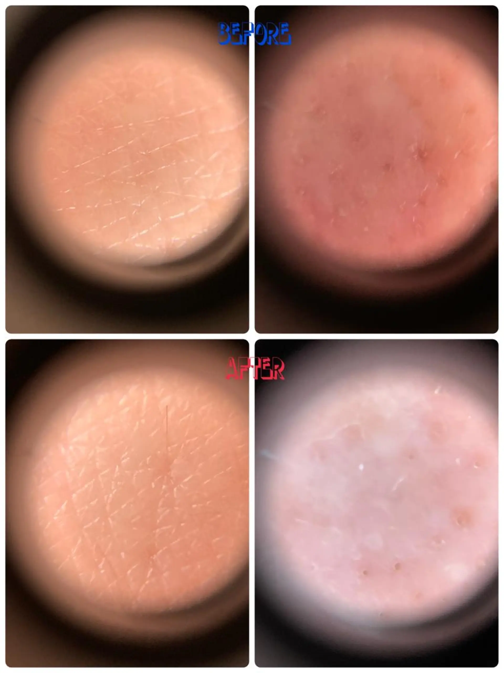 エステ 樋口 奈津希のエステ・リラクイメージ