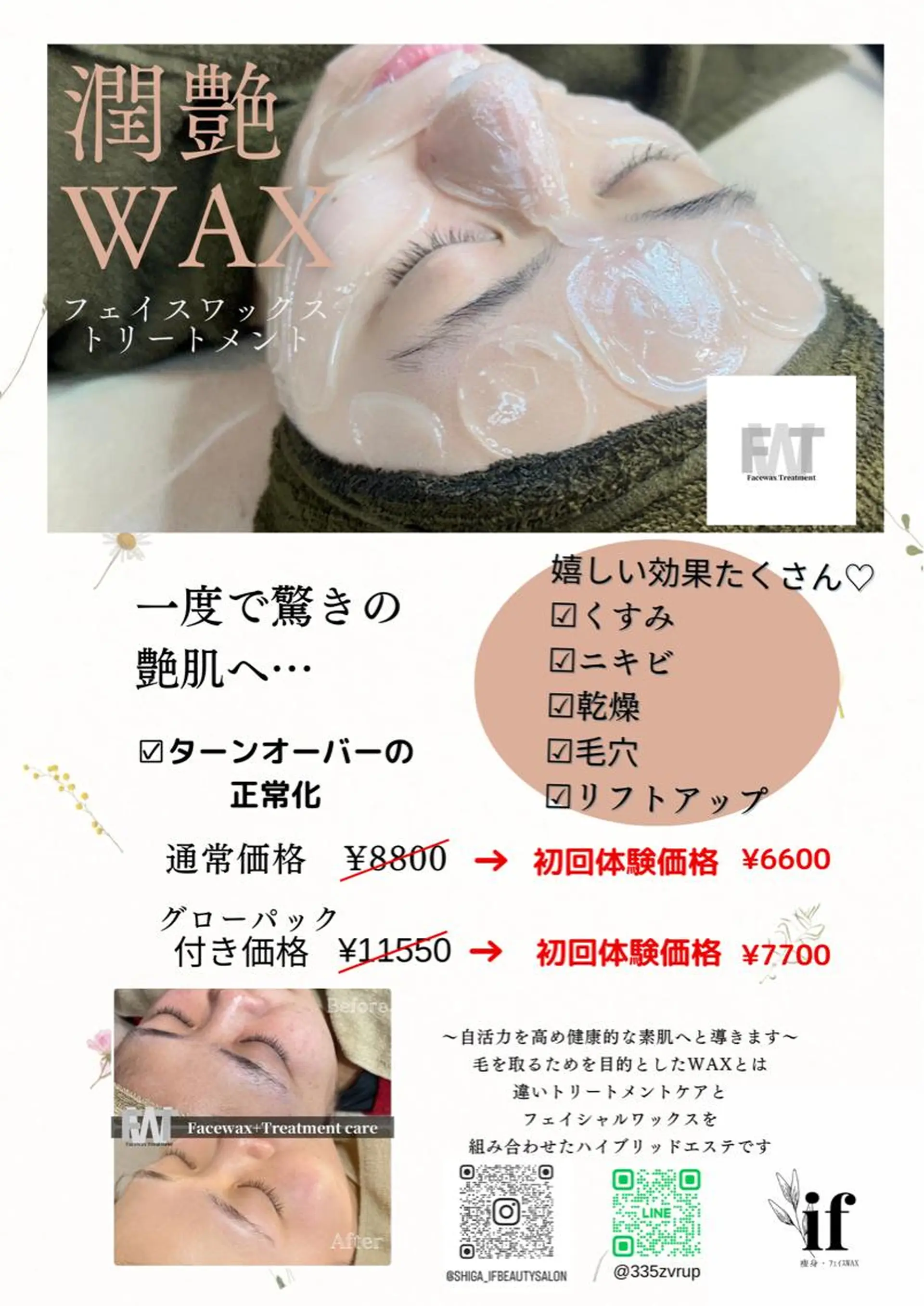 エステ リラク 痩身・フェイシャル/if  byOrabriller所属・if byOrab riller【ｲﾌ】のその他イメージ