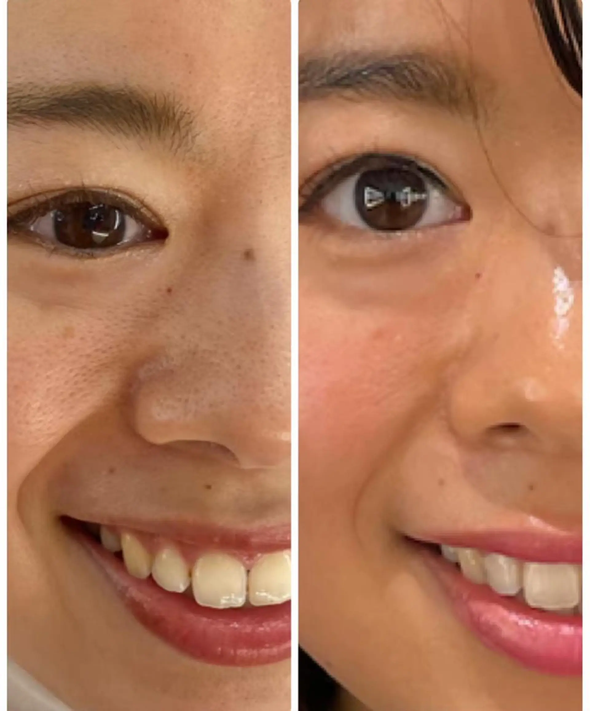 エステ pllia beautyのネイルデザイン