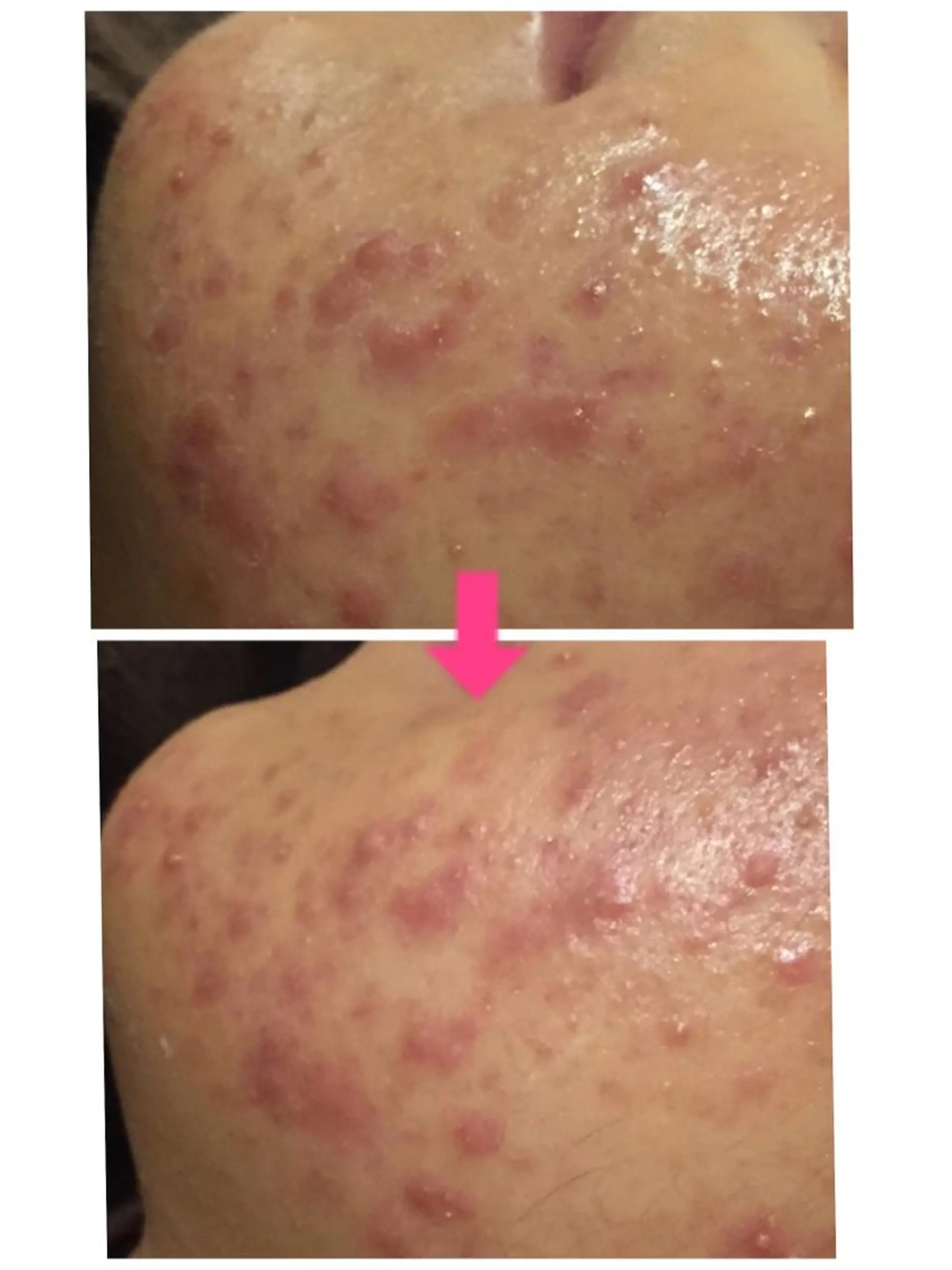 ロング カラー パーマ ヘアアレンジ メンズ キッズ ネイル マツエク・マツパ ‍痩身＆ボディ 結果出し🌟丹野のエステ・リラクイメージ