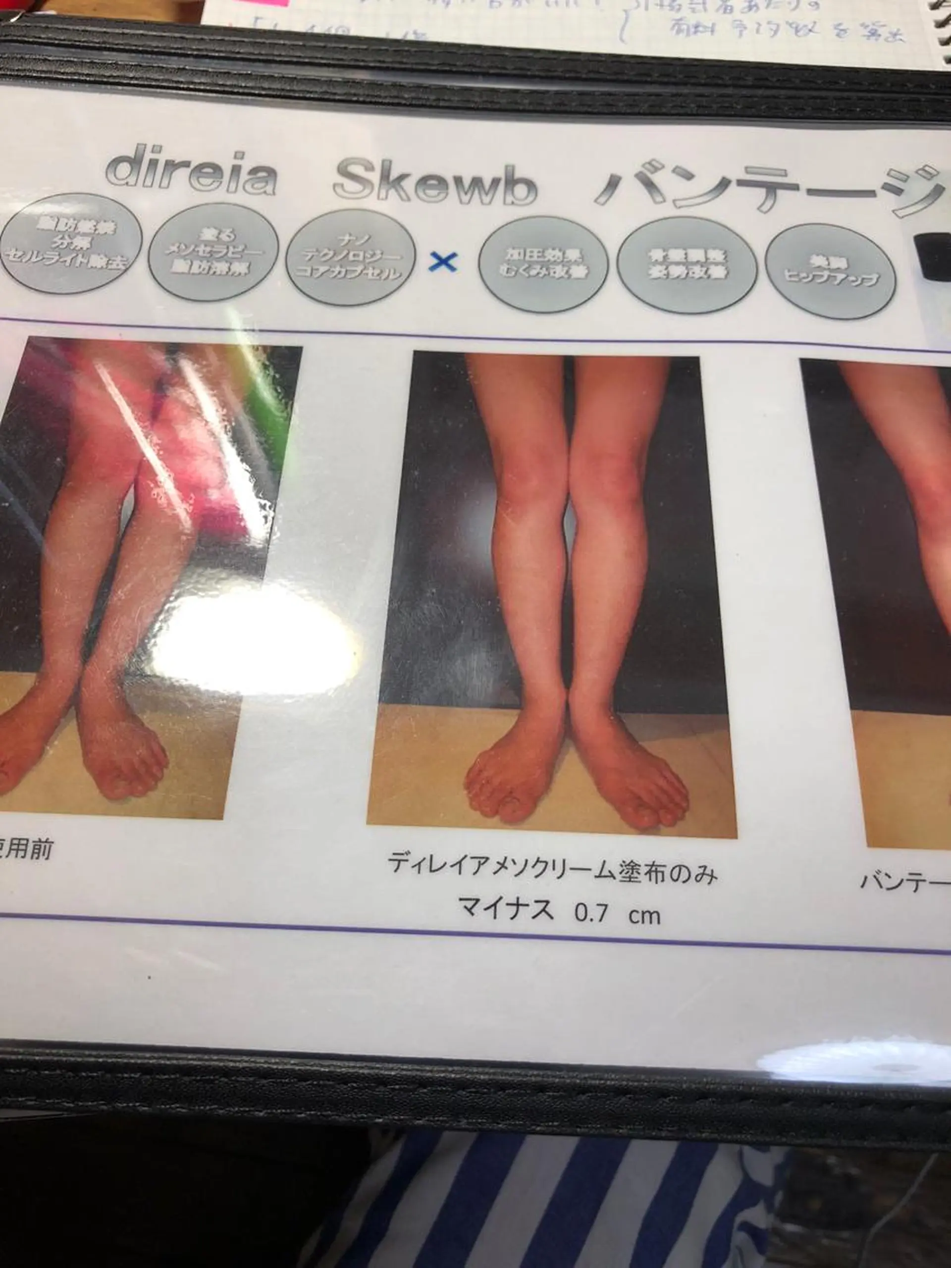 小尻・太もも痩せる エステルナボーテのエステ・リラクイメージ