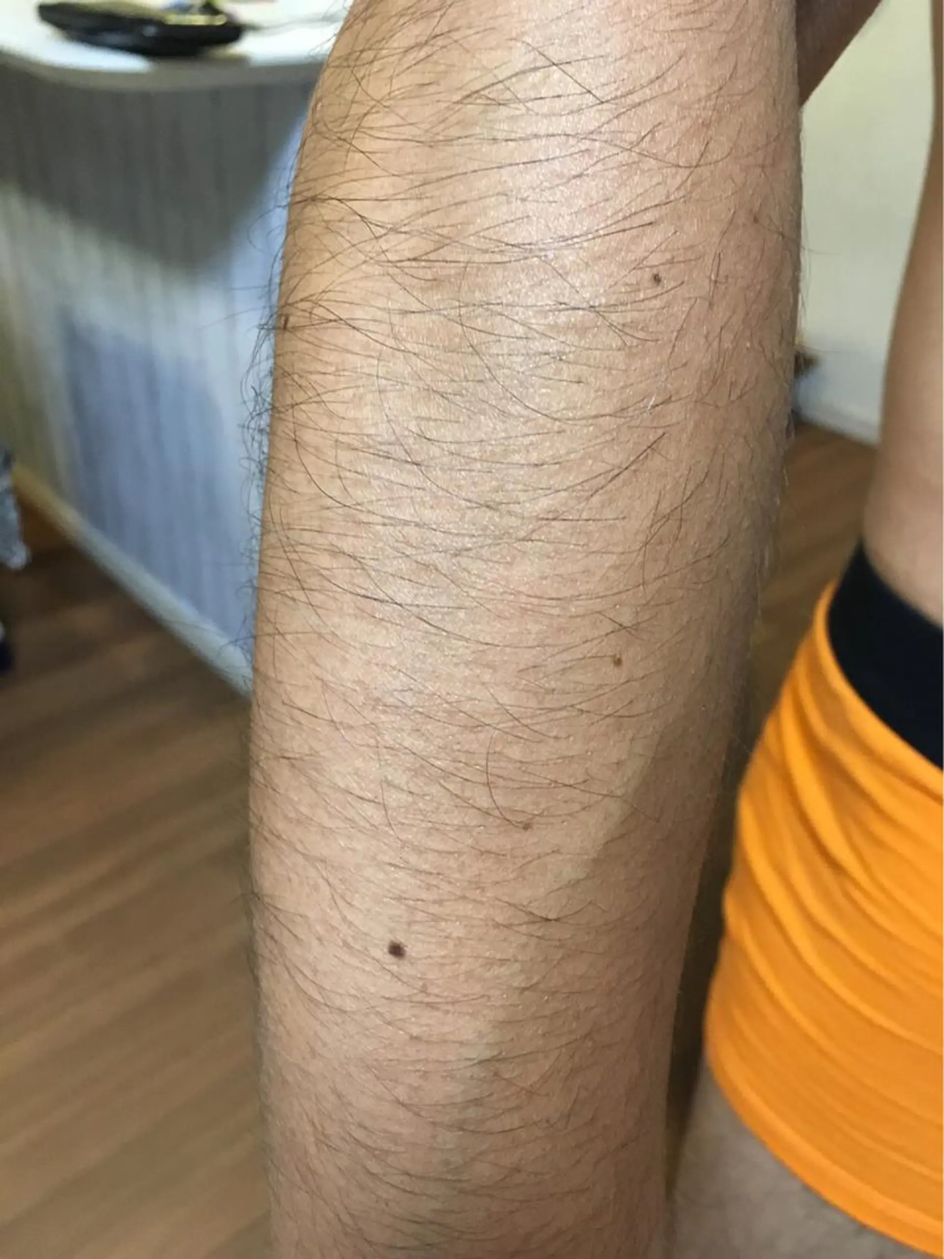 ネイル・脱毛サロンplage所属・脱毛サロン Plageプラージュのエステ・リラクイメージ