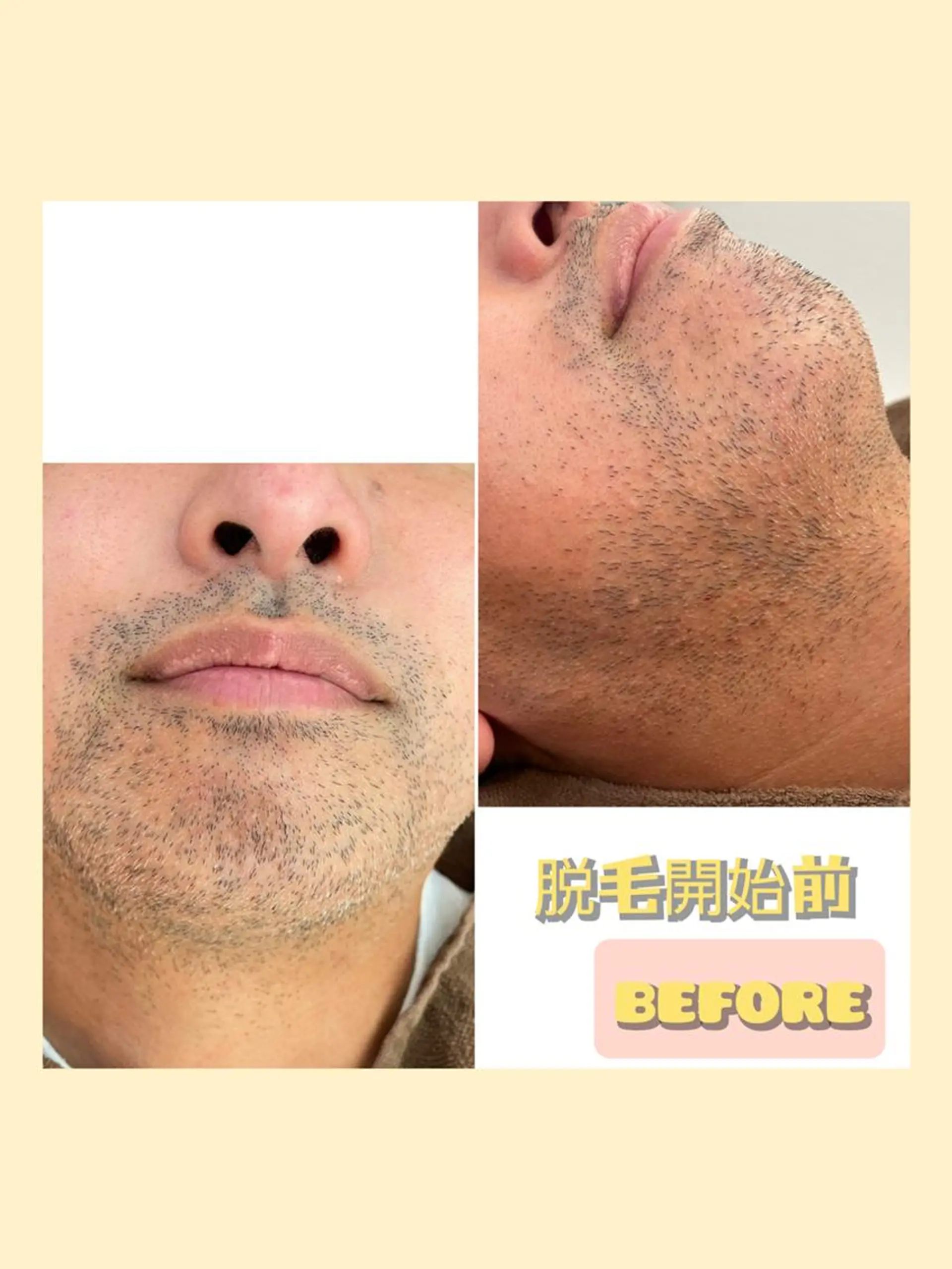 メンズ 脱毛 salonde ReGodのエステ・リラクイメージ