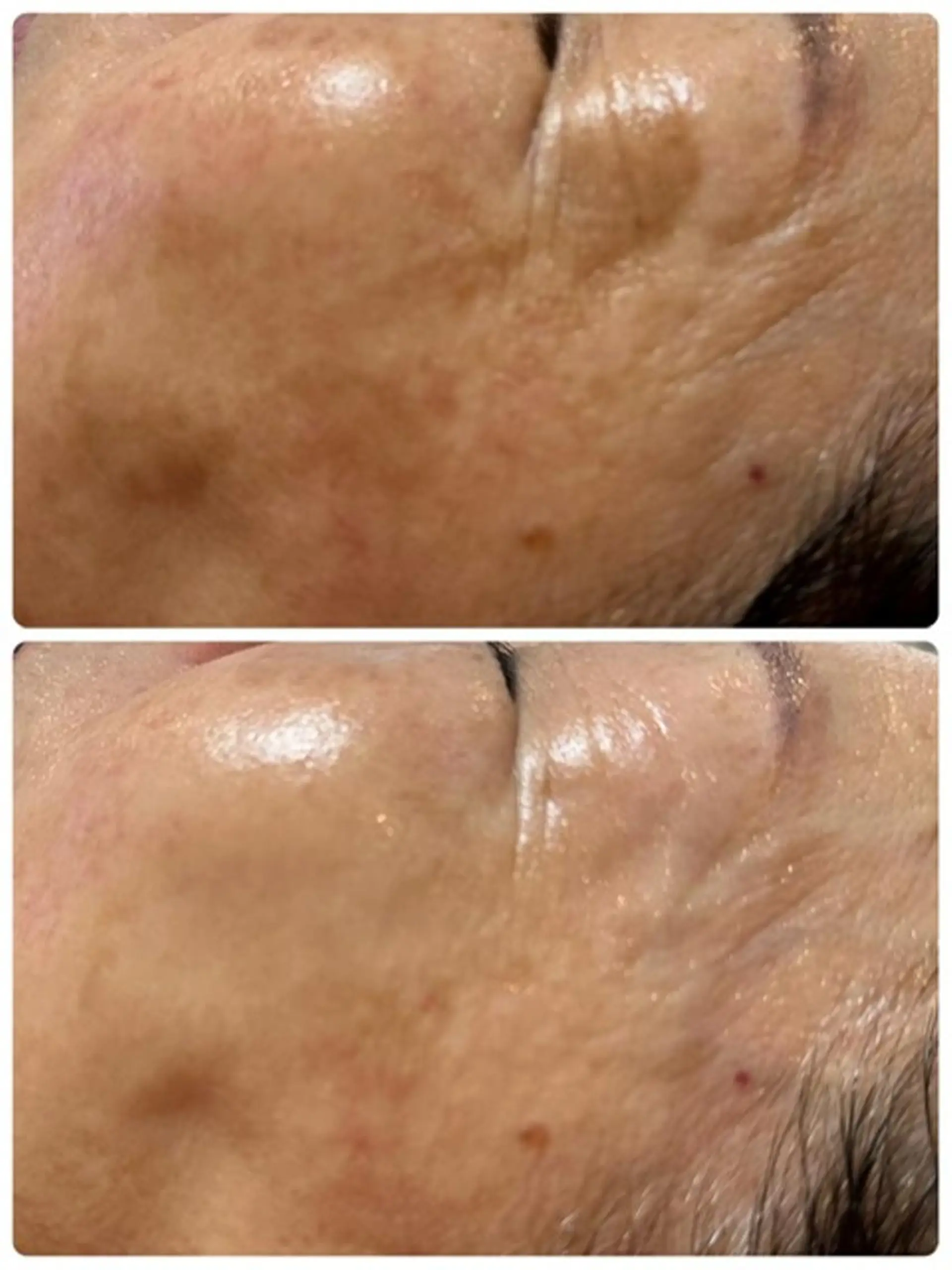 Lien オーナー　山口智嘉のエステ・リラクイメージ