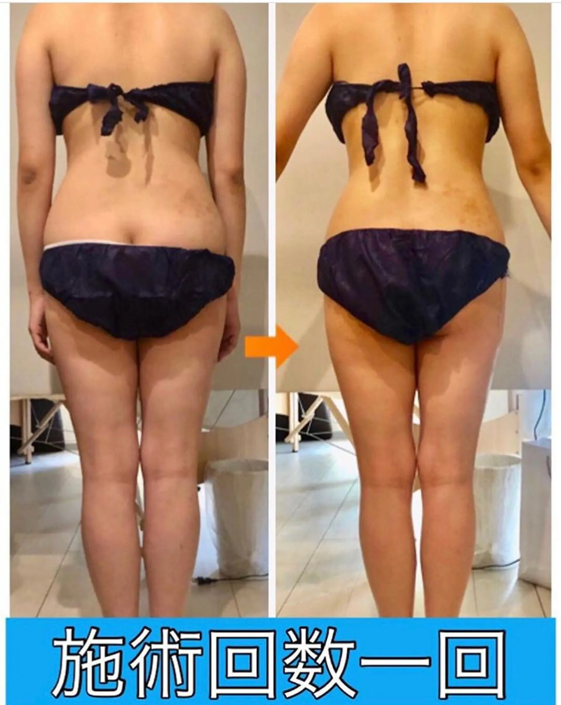 ロング カラー パーマ ヘアアレンジ メンズ キッズ ネイル マツエク・マツパ ‍痩身＆ボディ 結果出し🌟丹野のエステ・リラクイメージ