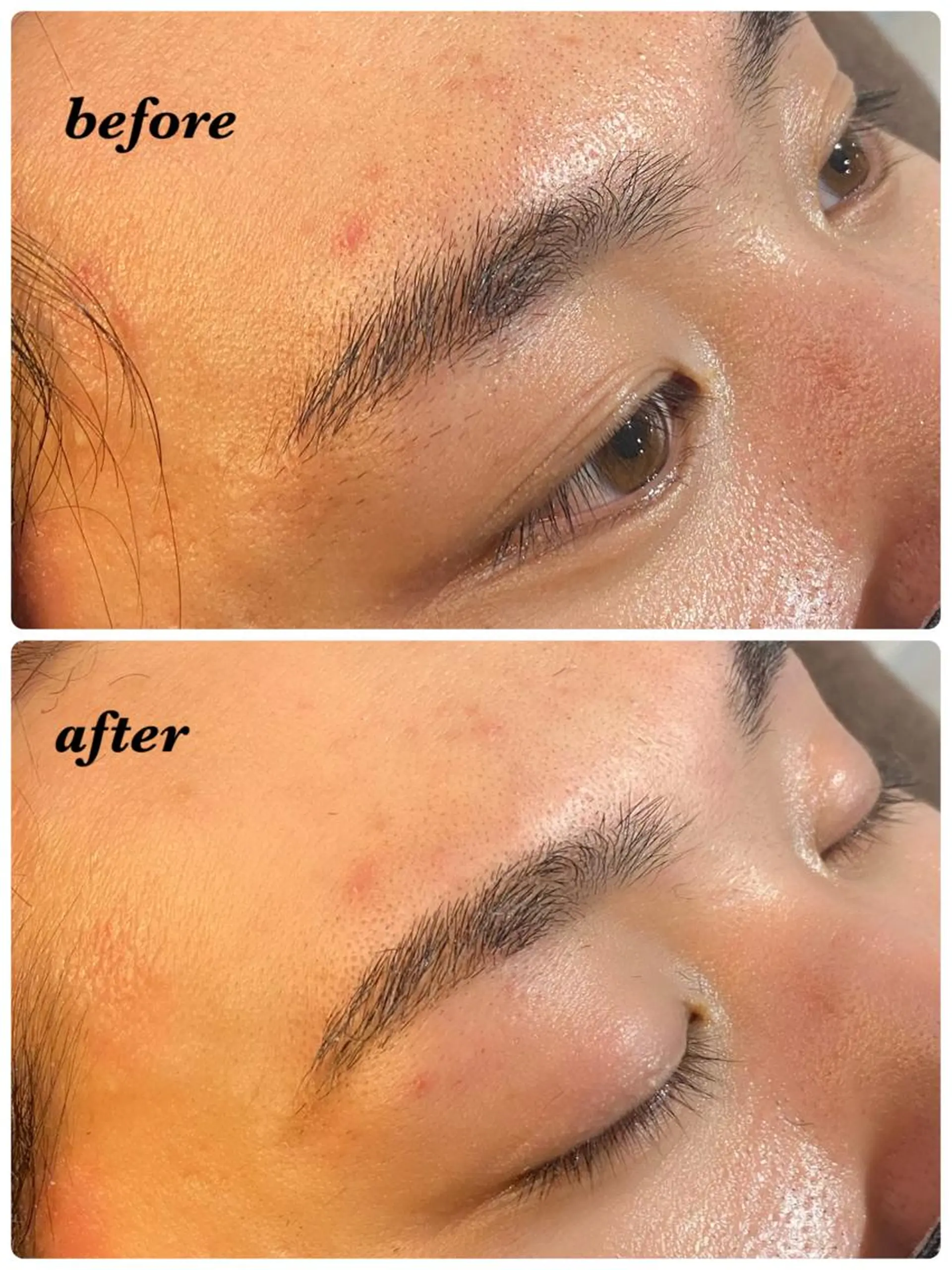 アイブロウ ハーブピーリング/韓国肌管理/フェイシャル/毛穴洗浄/眉毛/顔脱毛【糸脱毛専門】rev所属・ハーブピーリング🌹 毛穴洗浄❤️眉waxのエステ・リラクイメージ