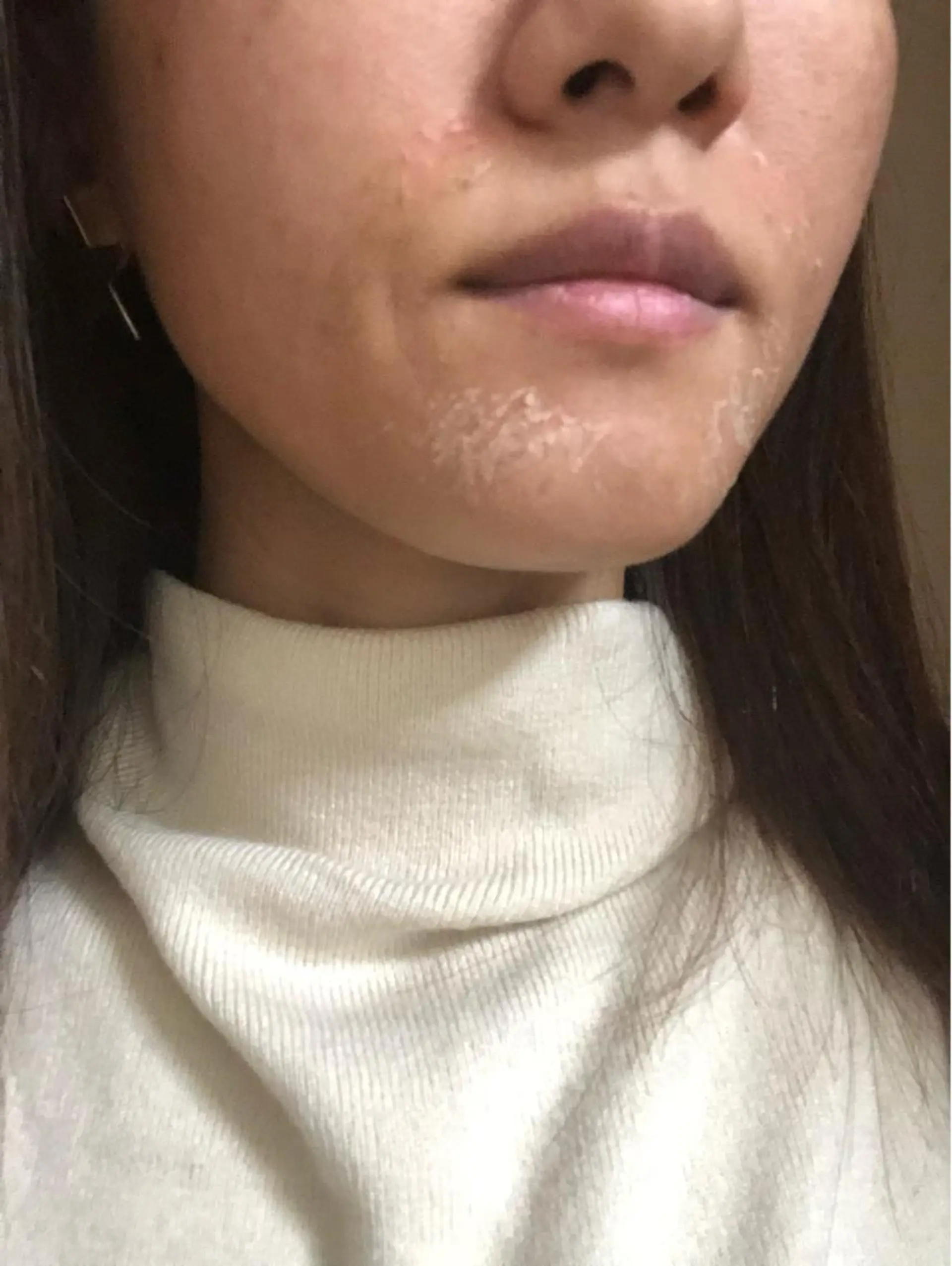 Momo Eggs所属・Momo Eggsのエステ・リラクイメージ