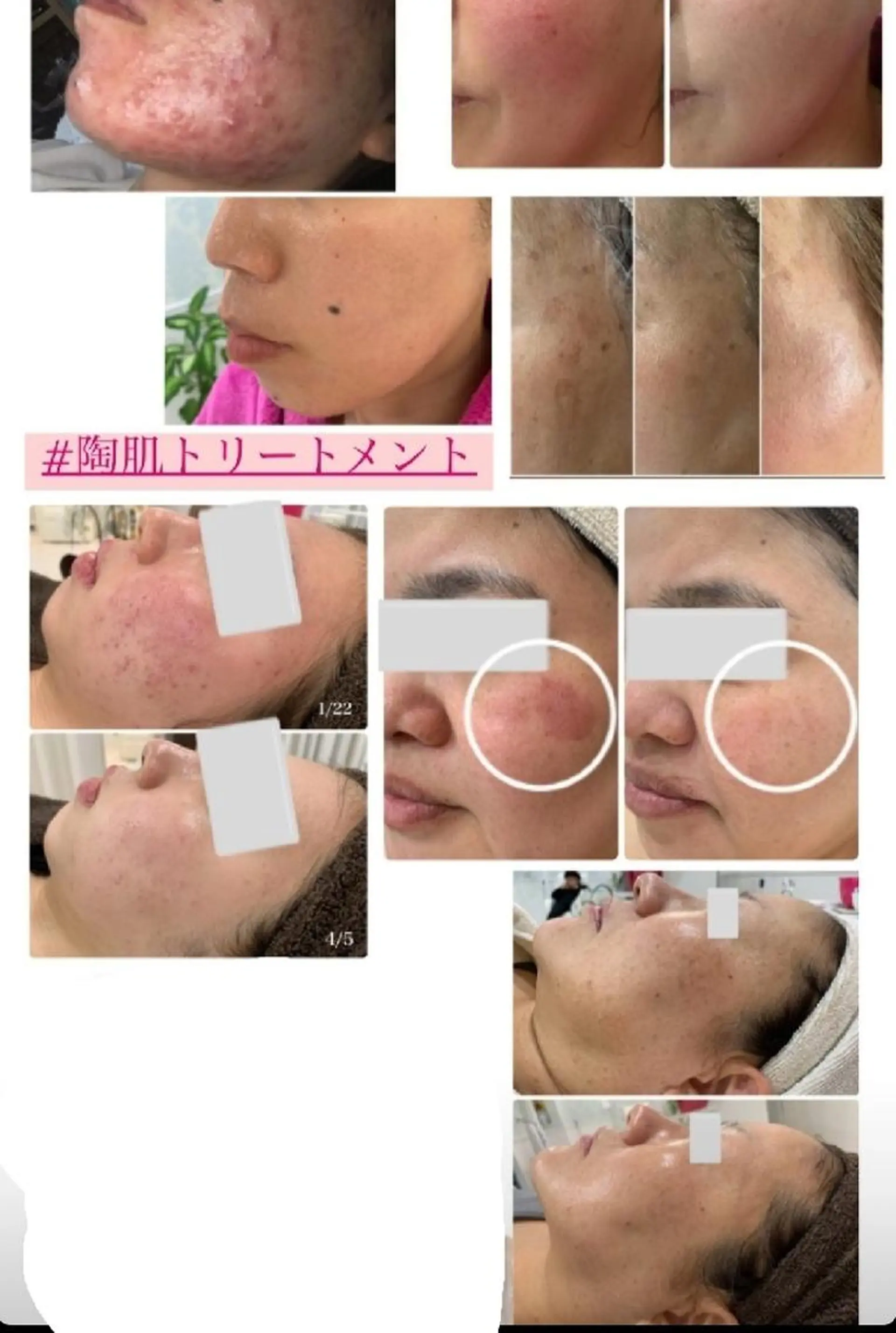 PIP🌹 さえのマツエク・マツパデザイン