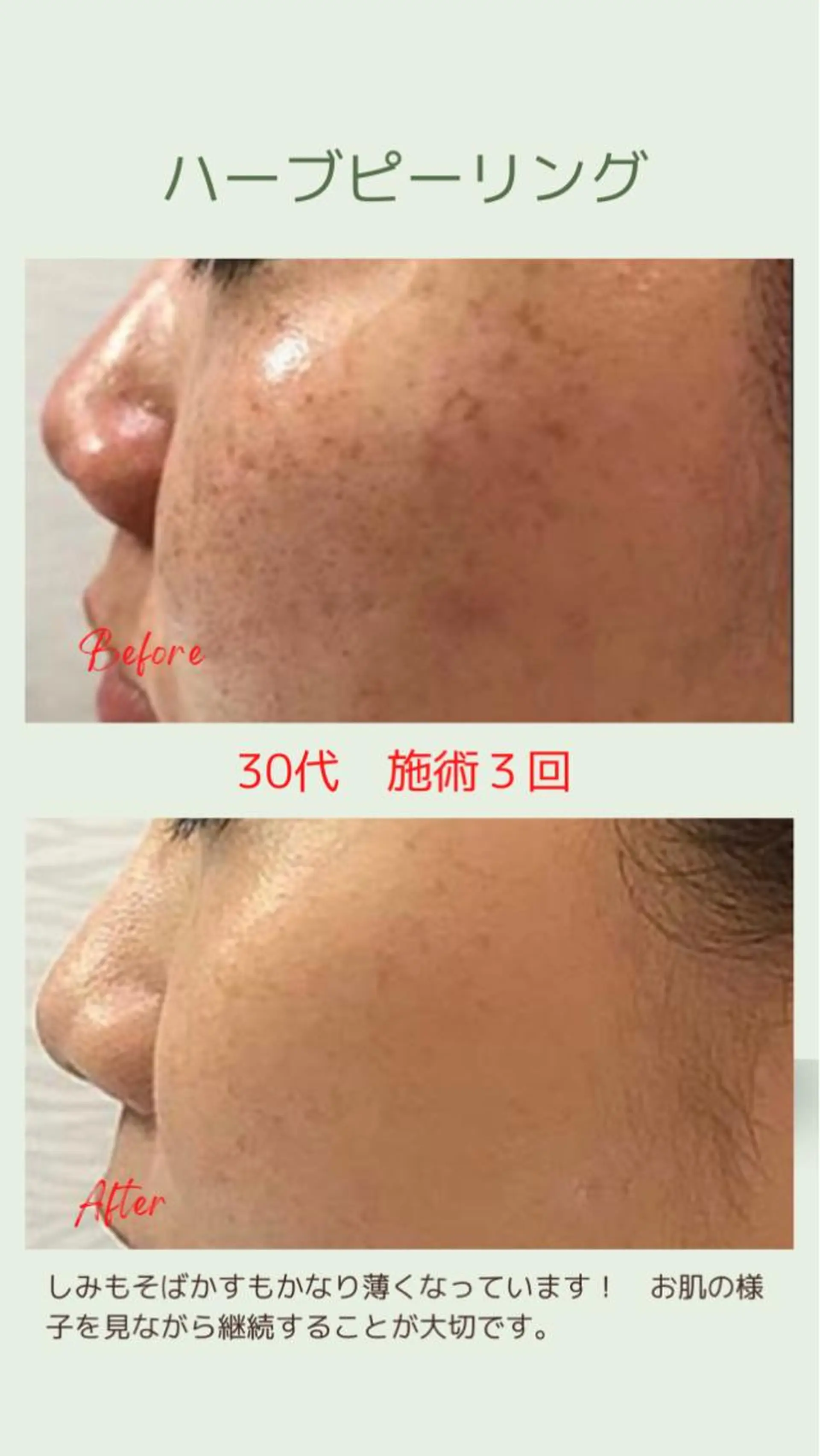 ベラージュ【美背中・ 美尻・フェイシャル】のエステ・リラクイメージ